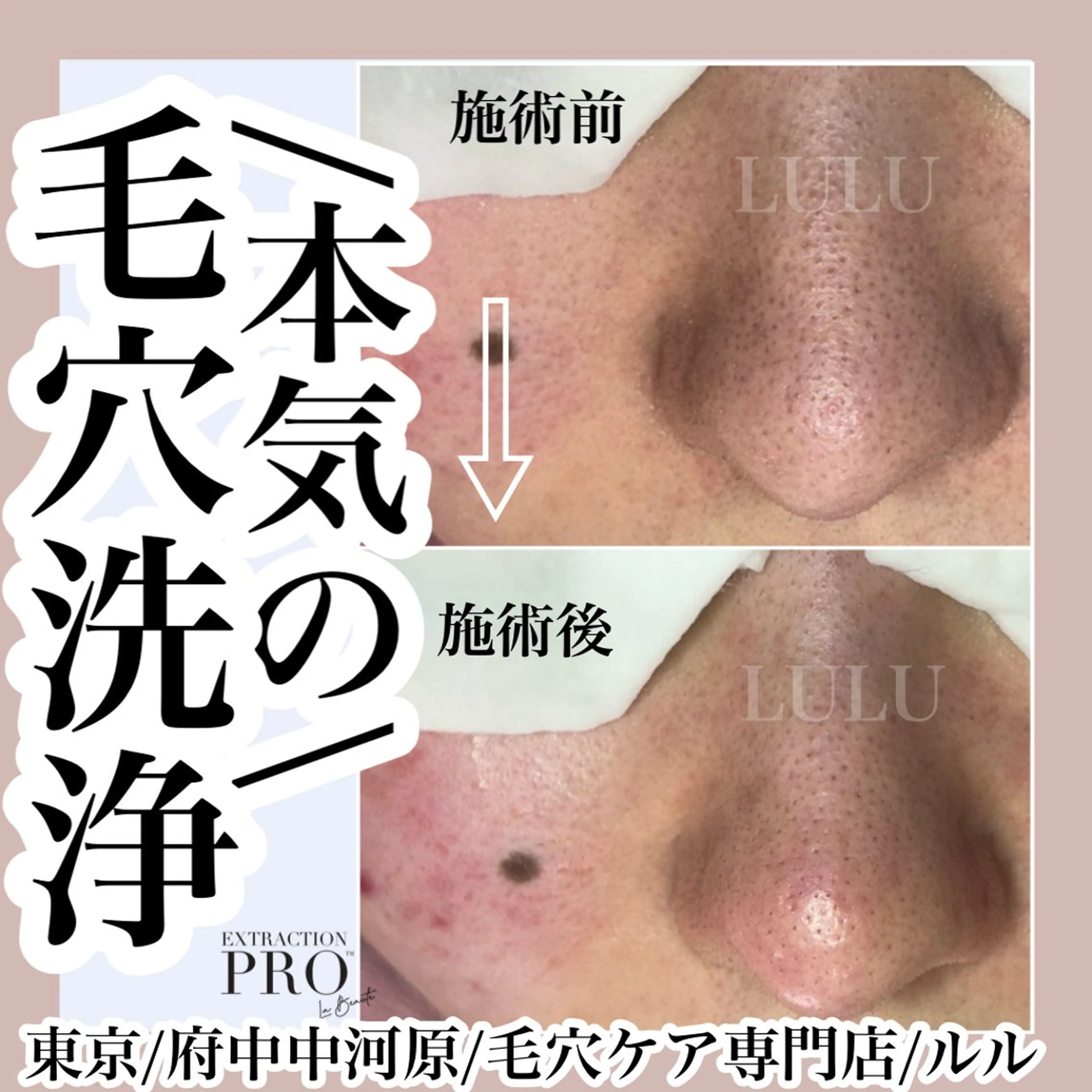 エステ LULU所属・LULU ルルのエステ・リラクイメージ