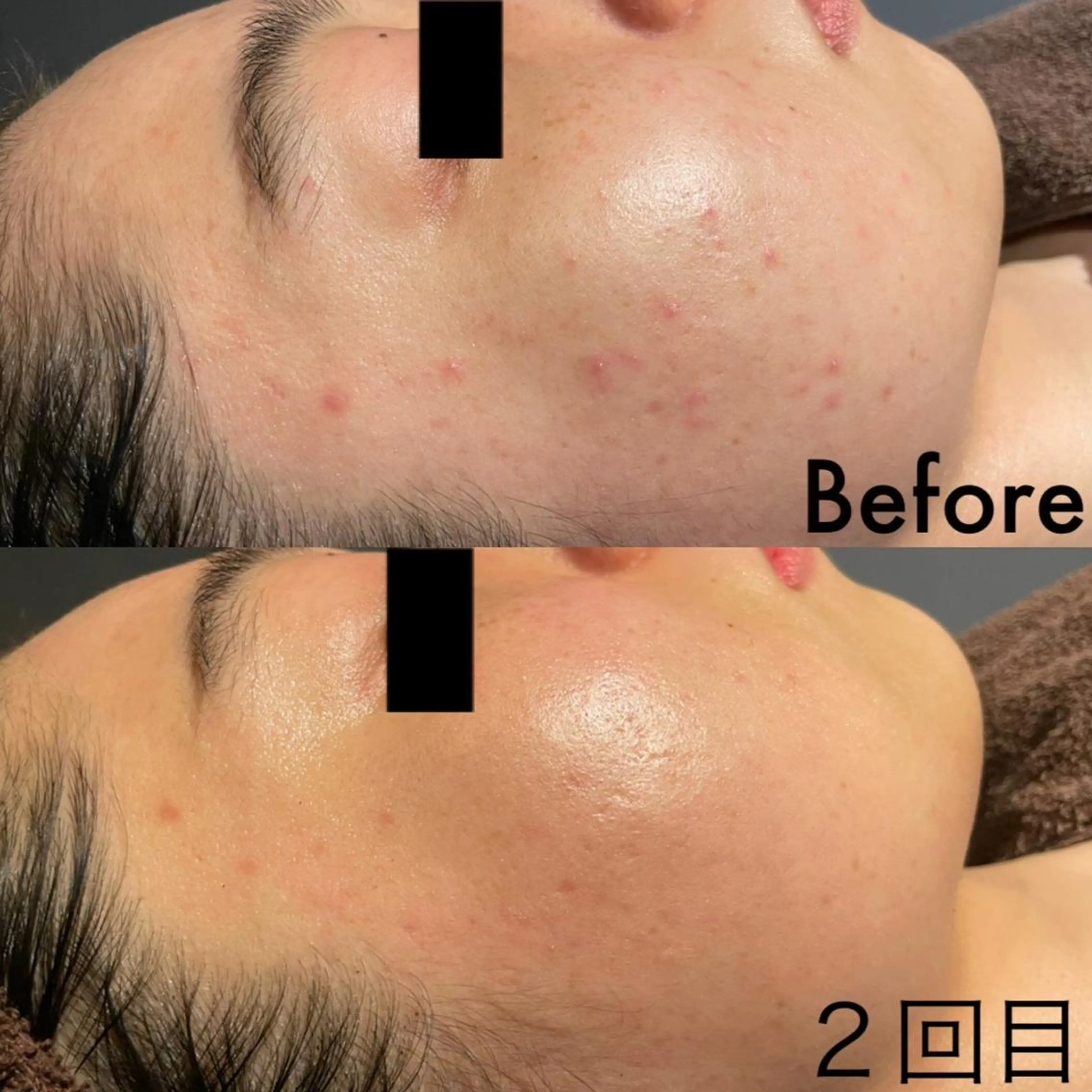 エステ エステ脱毛 MAIのエステ・リラクイメージ