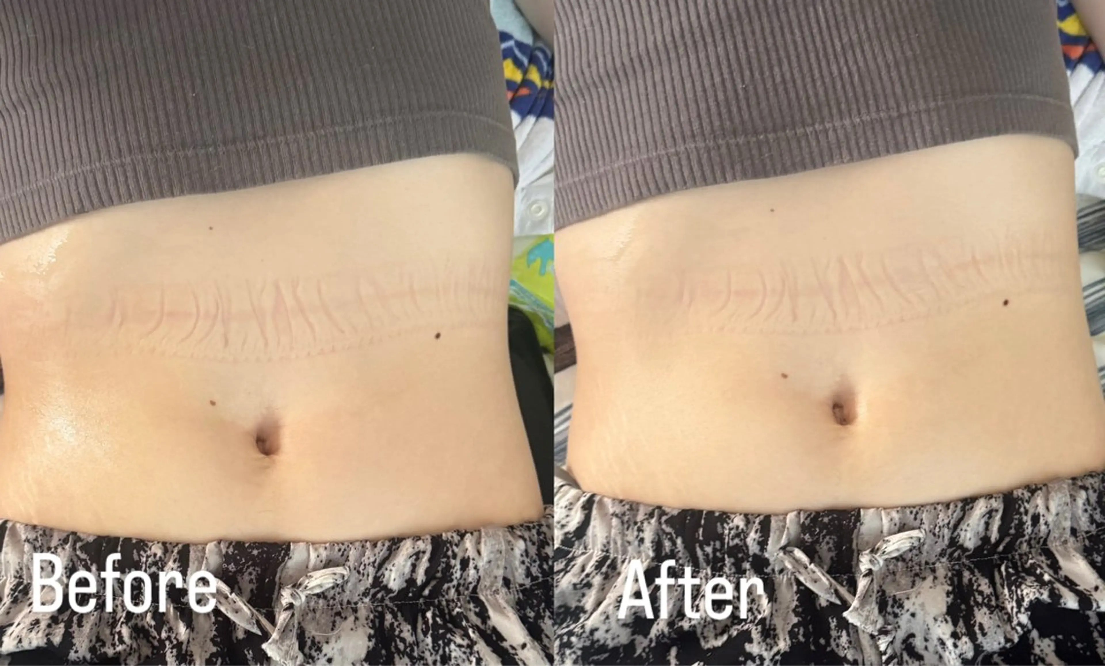 上半身痩身の写真