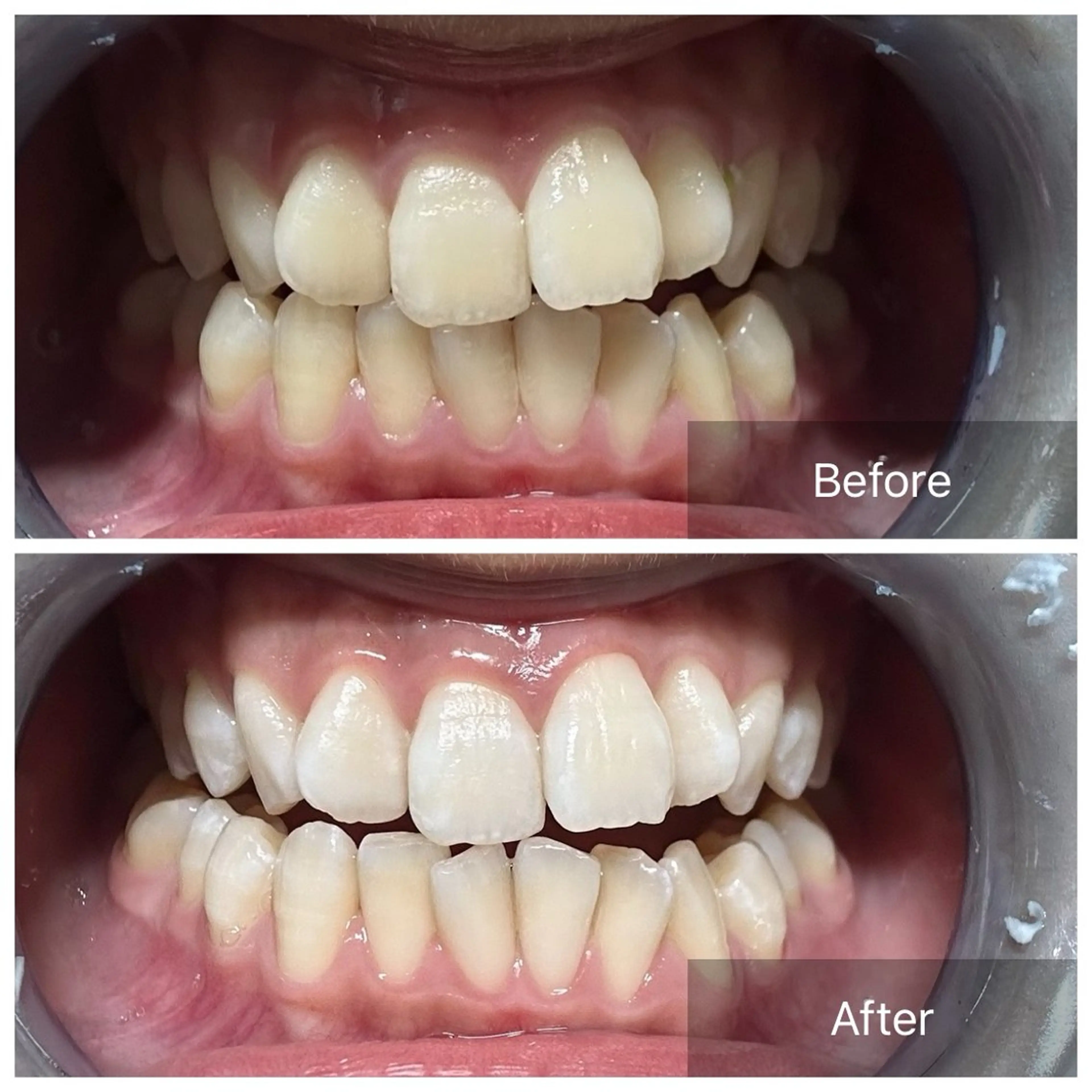 その他 セルフホワイトニング サクッとホワイト   立川店所属・サクッとホワイト 立川店のその他イメージ