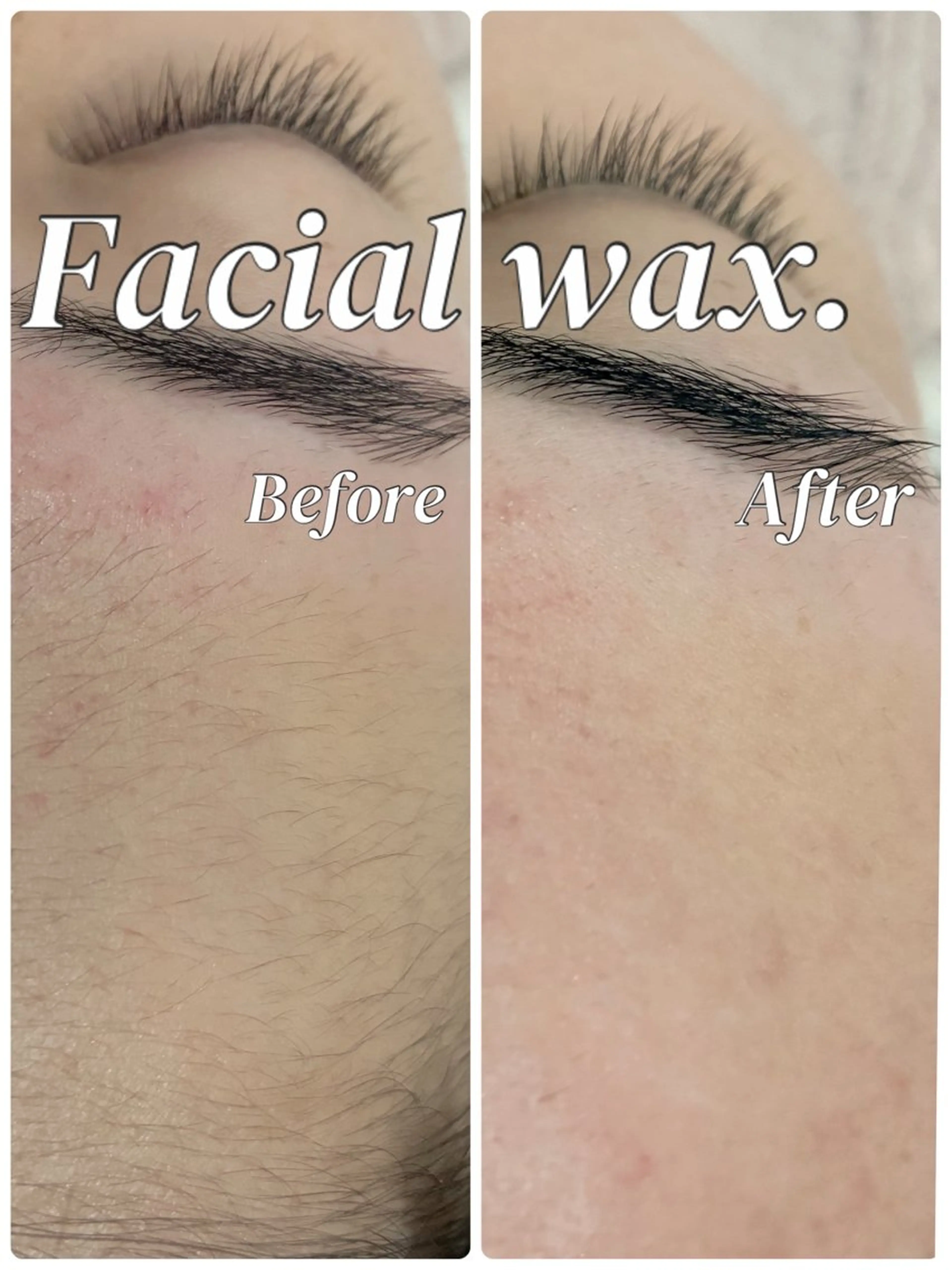 💕大好評つるつるお肌💕🫧フェイシャルwaxフル5️⃣パーツ🫧 女性限定🚺の写真