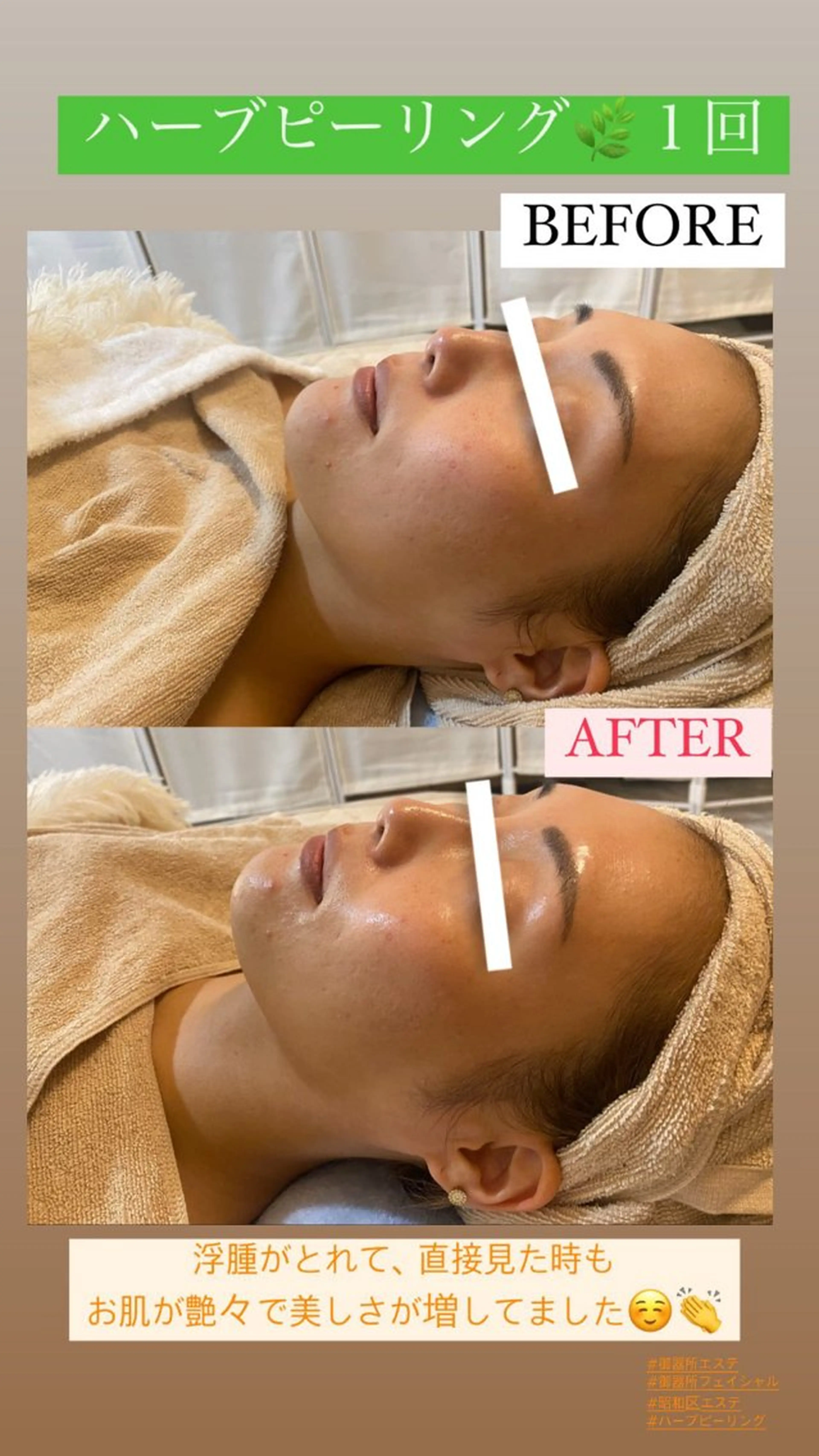 エステ Salon de Lino 御器所のエステ・リラクイメージ