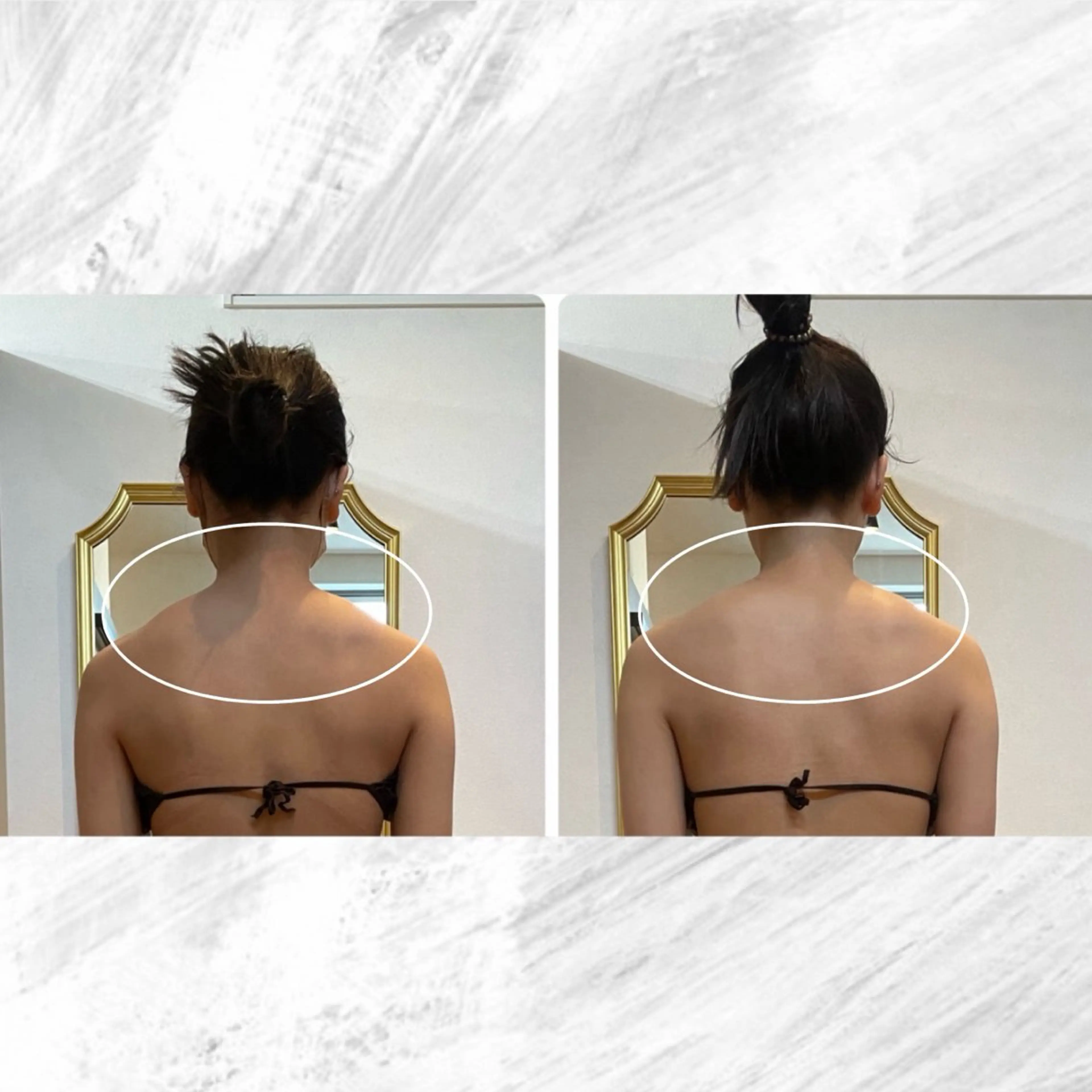 ハイパーナイフ 上半身or下半身の写真