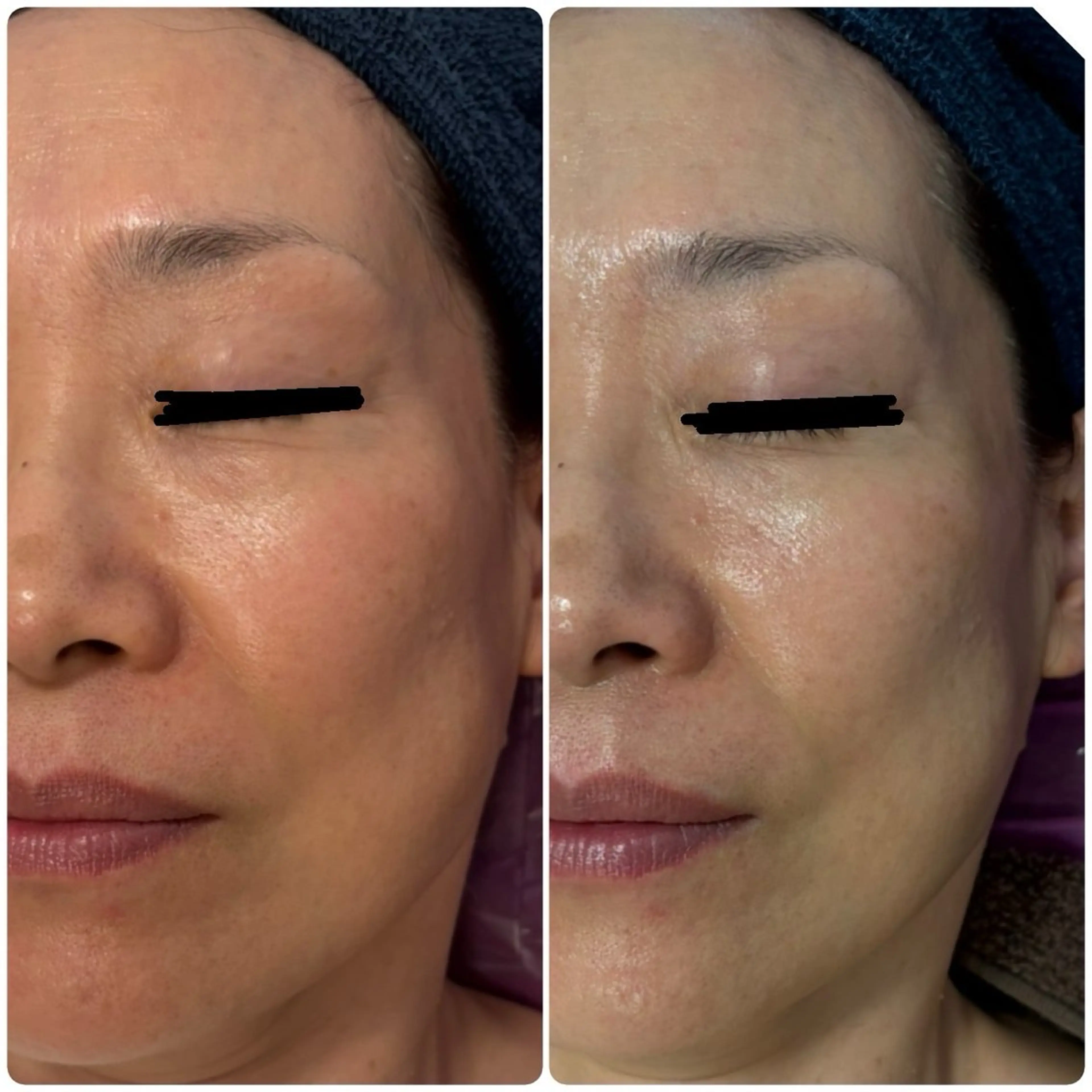 エステ リラク 💆‍♀️松田 亜沙美のエステ・リラクイメージ