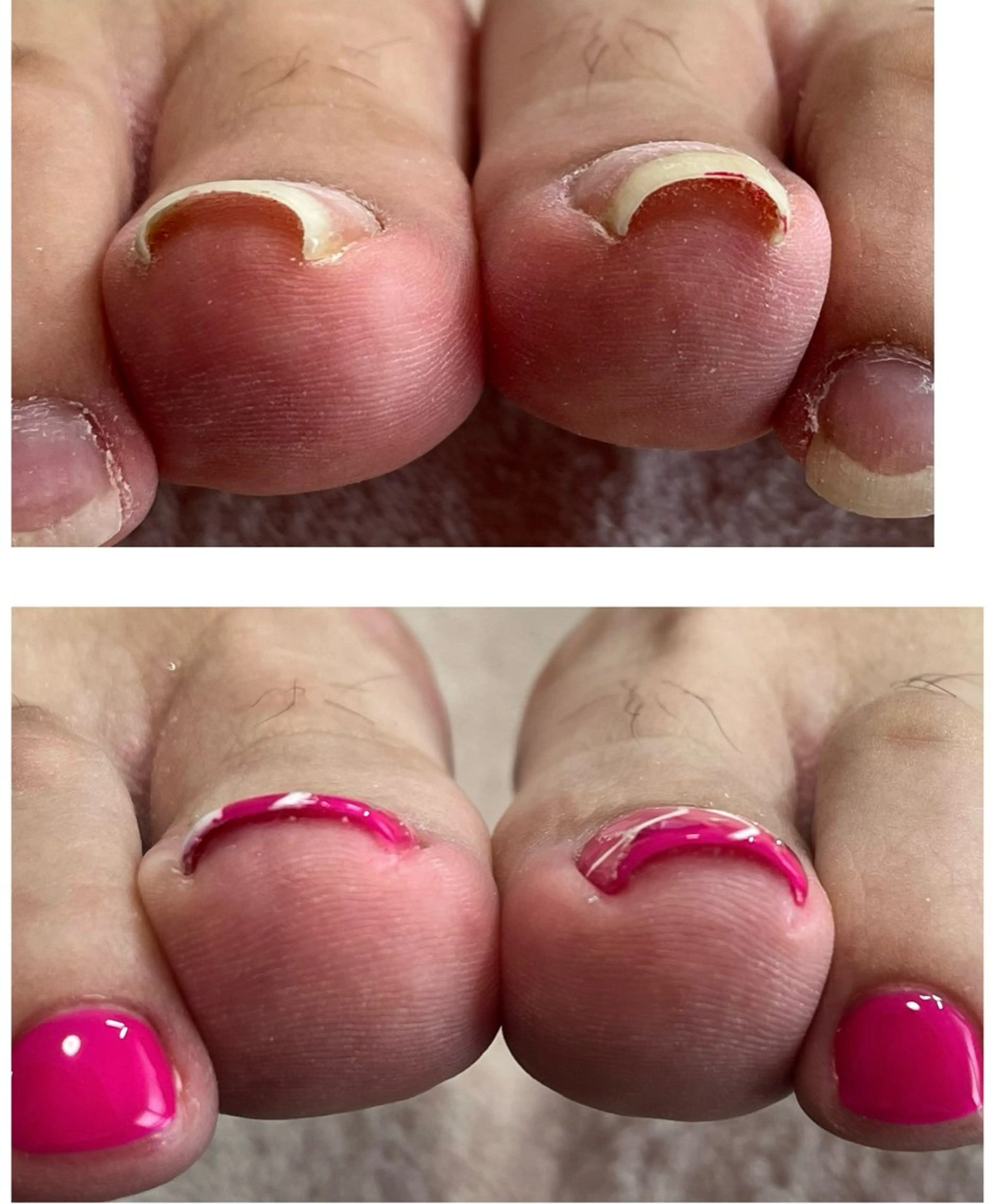 37 beautyのネイルデザイン