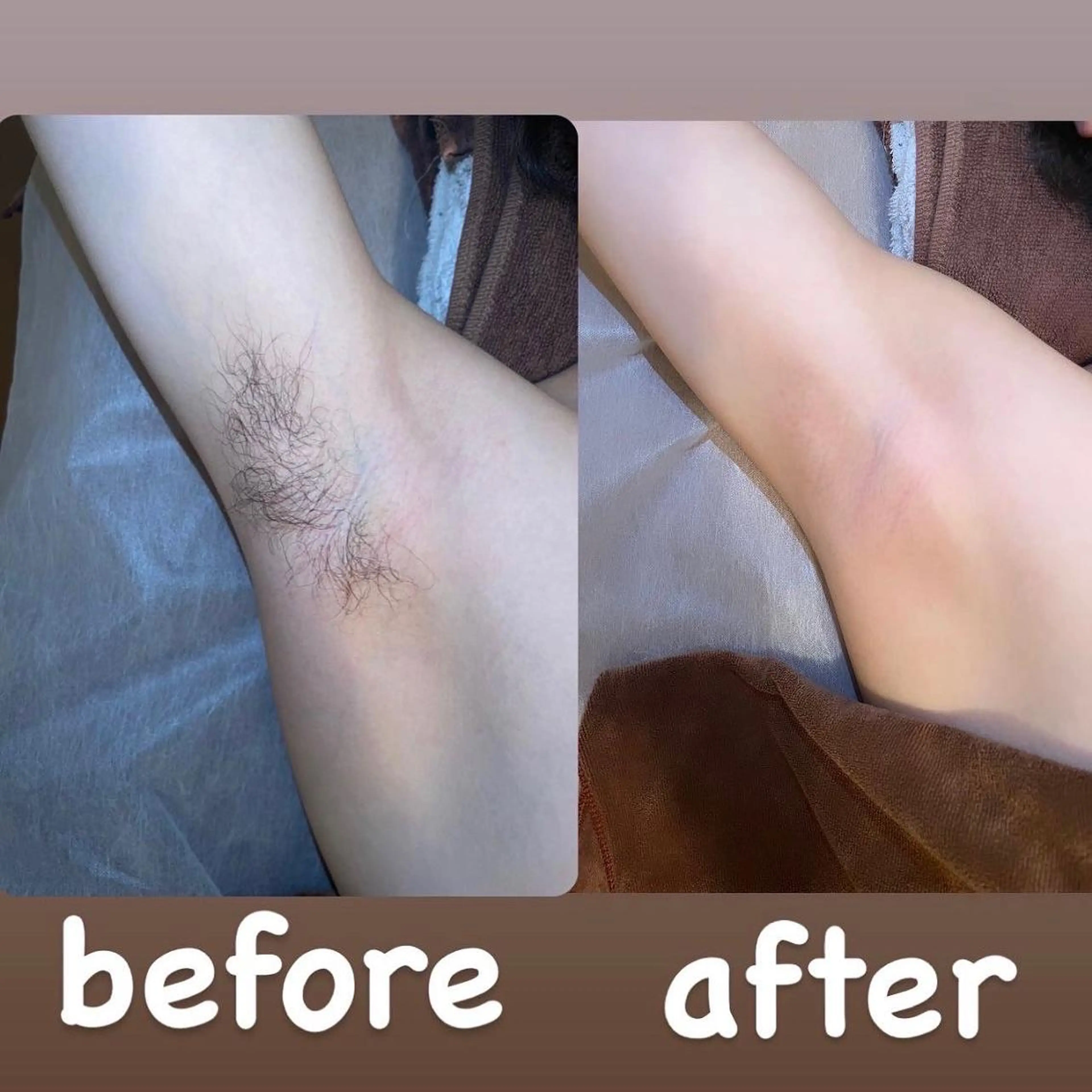 ✨メンズ✨脇　わき　   ブラジリアンワックス脱毛　￥3300の写真