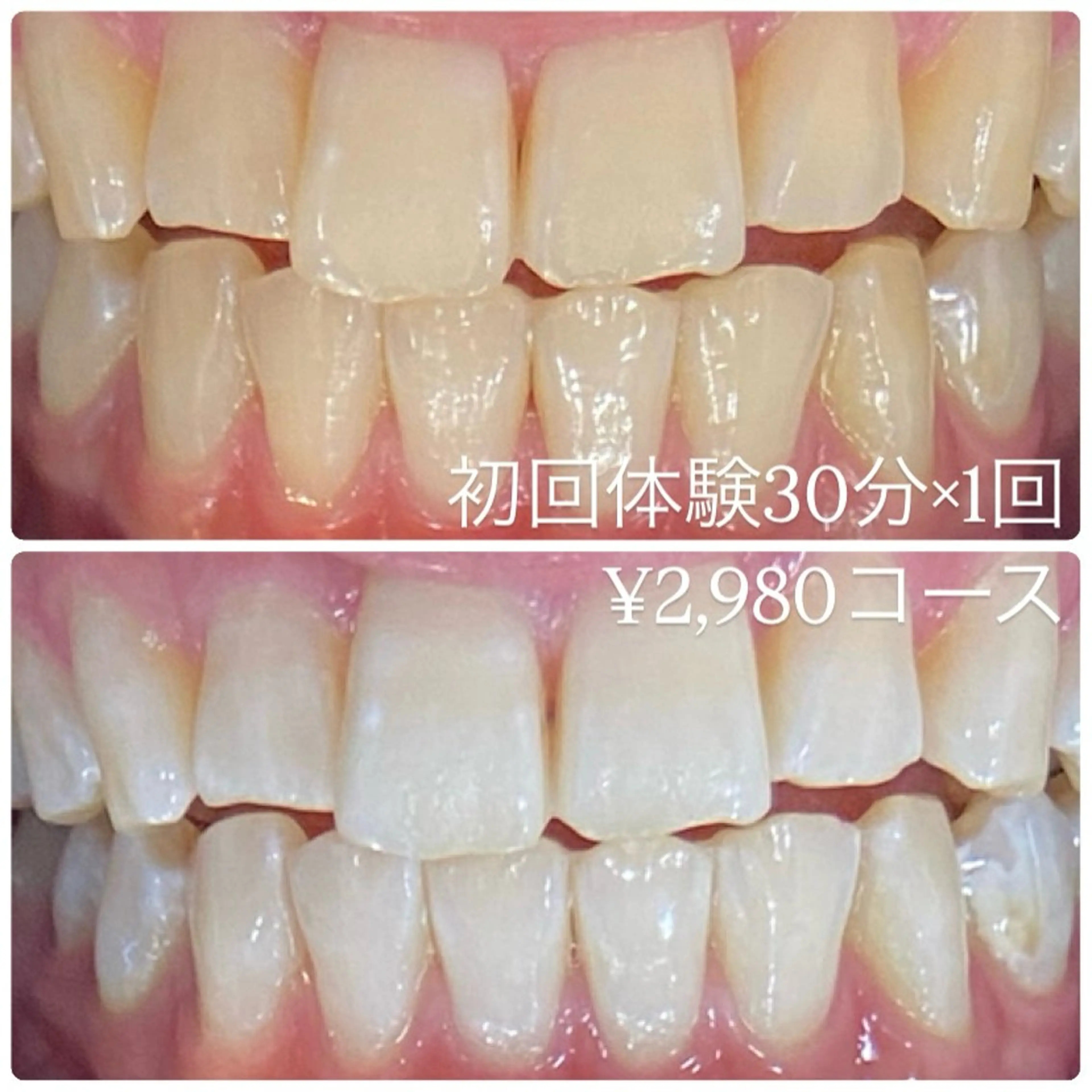 PLATINUM Beauty 横浜店所属・ホワイトニングルーム 横浜店のその他イメージ