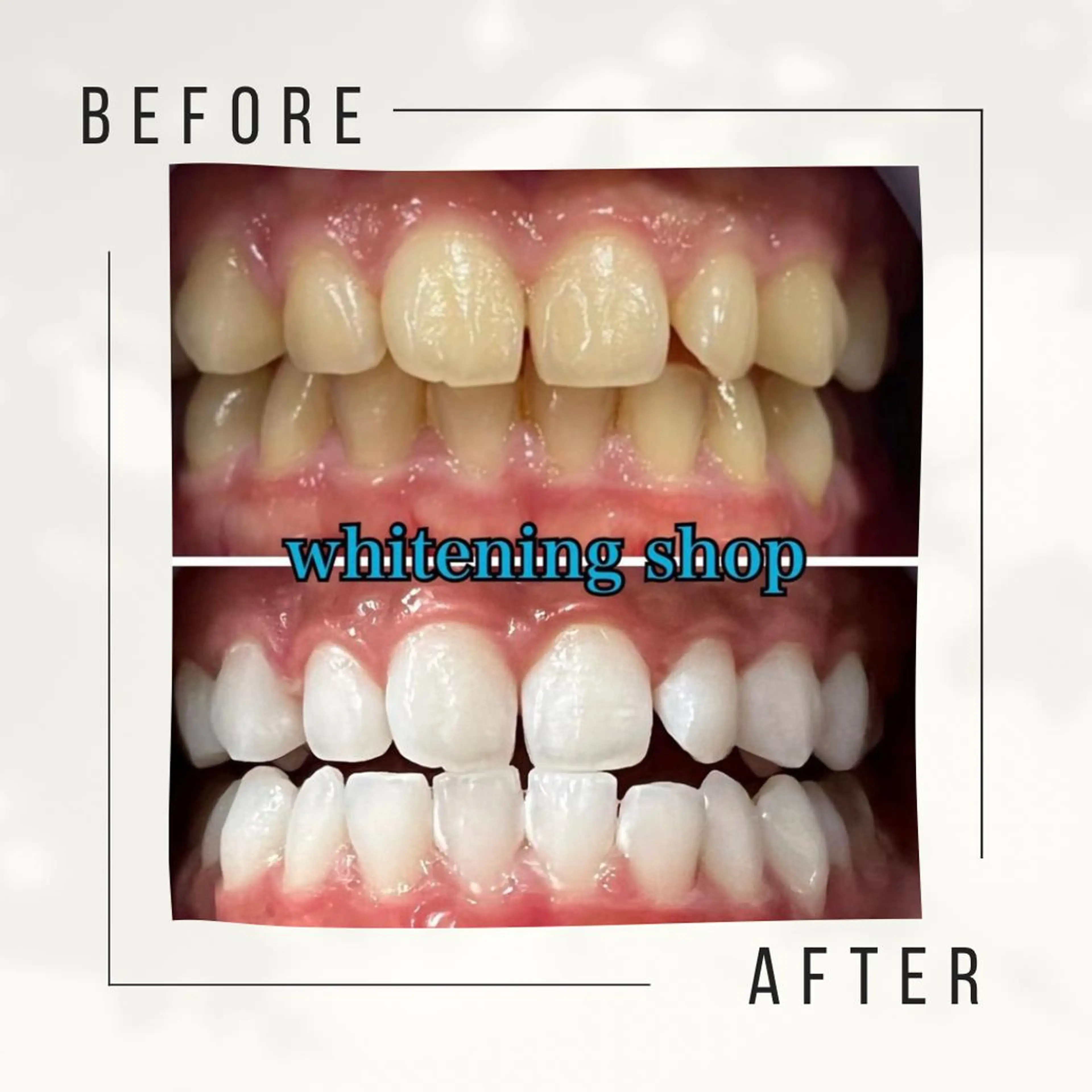 アイブロウ ホワイトニング ショップ千葉店のその他イメージ