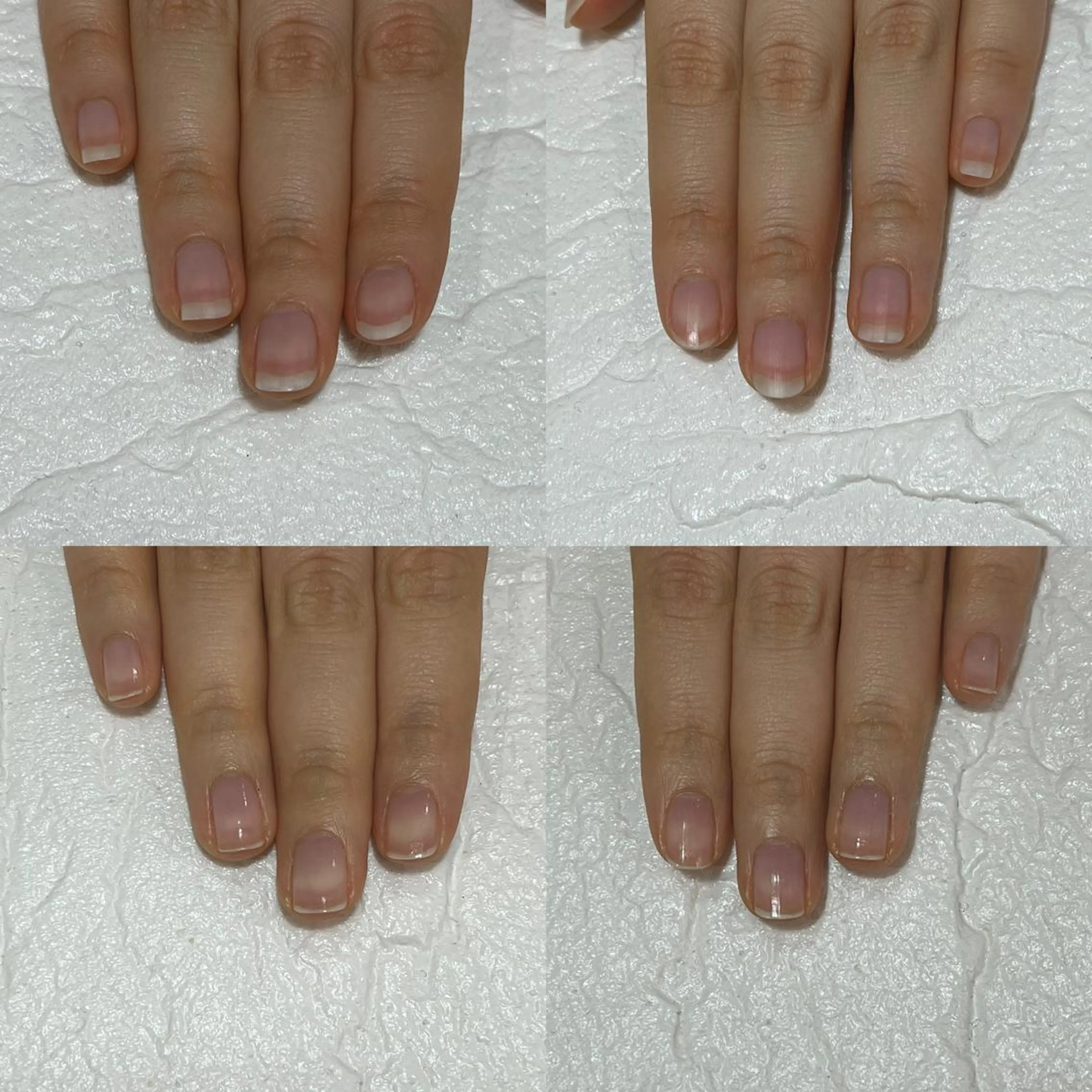 ネイル 自爪育成・巻き爪 補正講師　津蔵のネイルデザイン