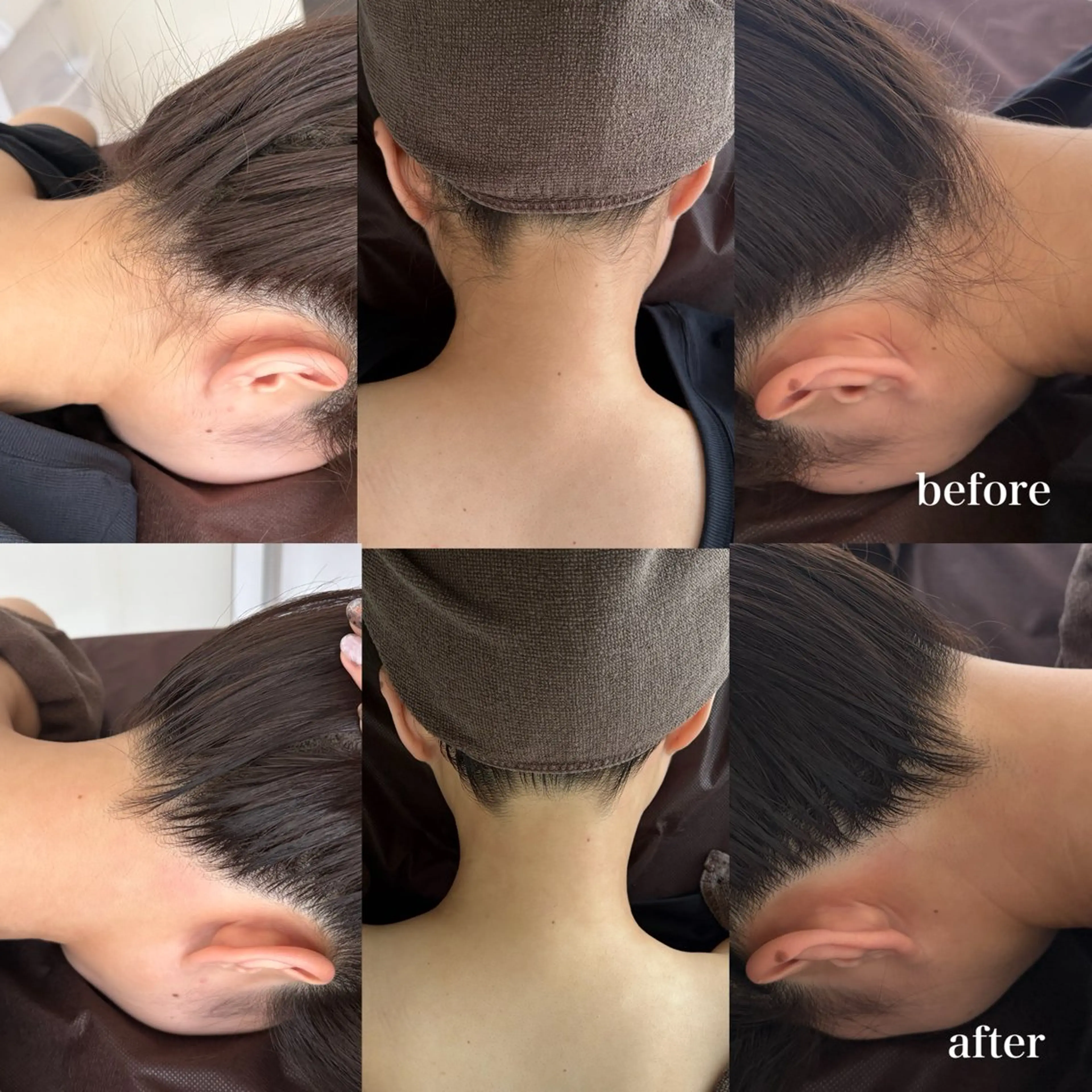 脱毛 美肌脱毛サロン Darius 上野所属・とよの みゆのエステ・リラクイメージ