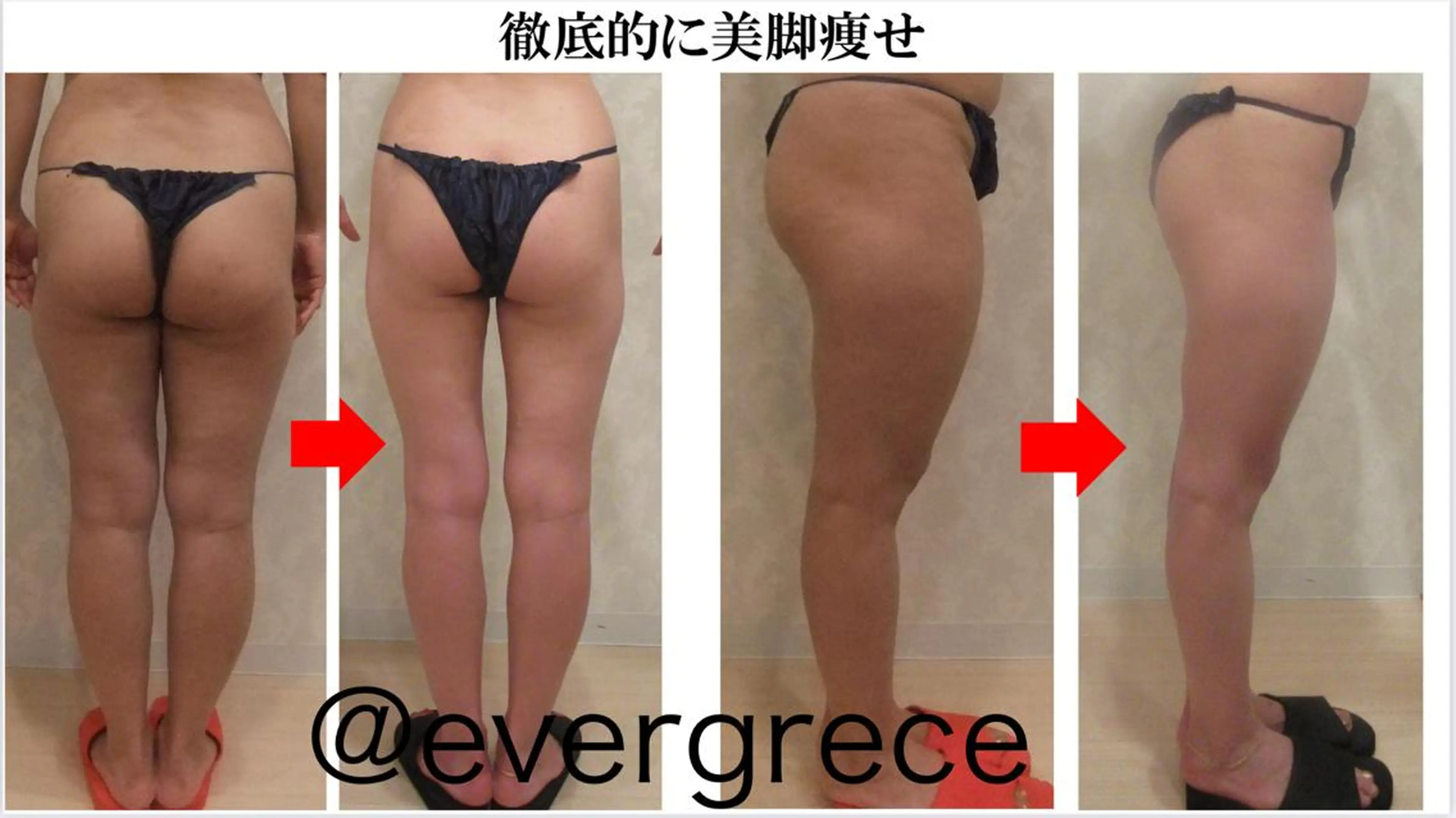 【下半身集中スリム】ヒップ・太もも・むくみ・冷え・脂肪撃退徹底部分集中コース！の写真