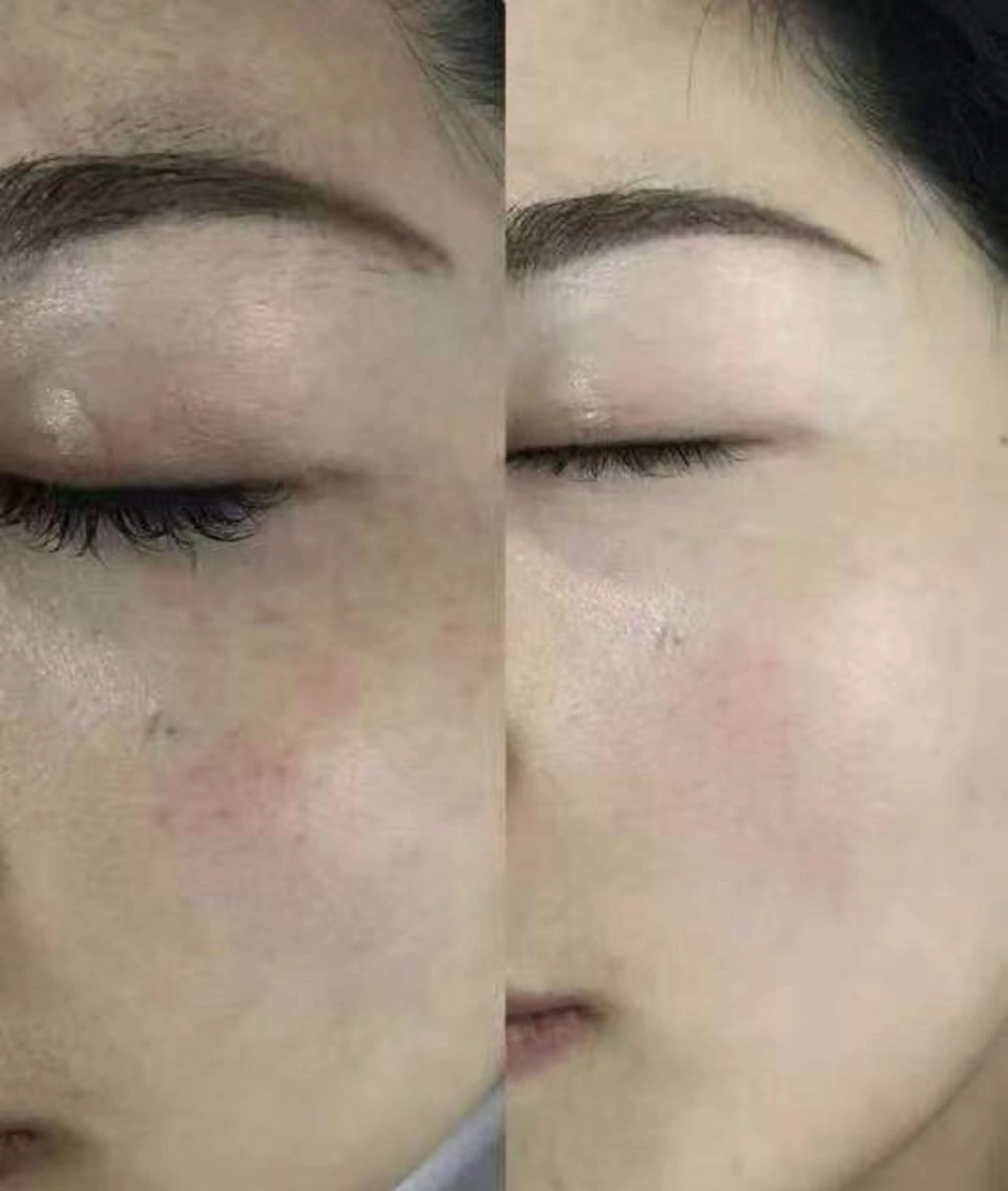 マツエク・マツパ エステ リラク 愛維美水光美肌専門店所属・愛維美水光美肌専門店 メンズレディースokのエステ・リラクイメージ