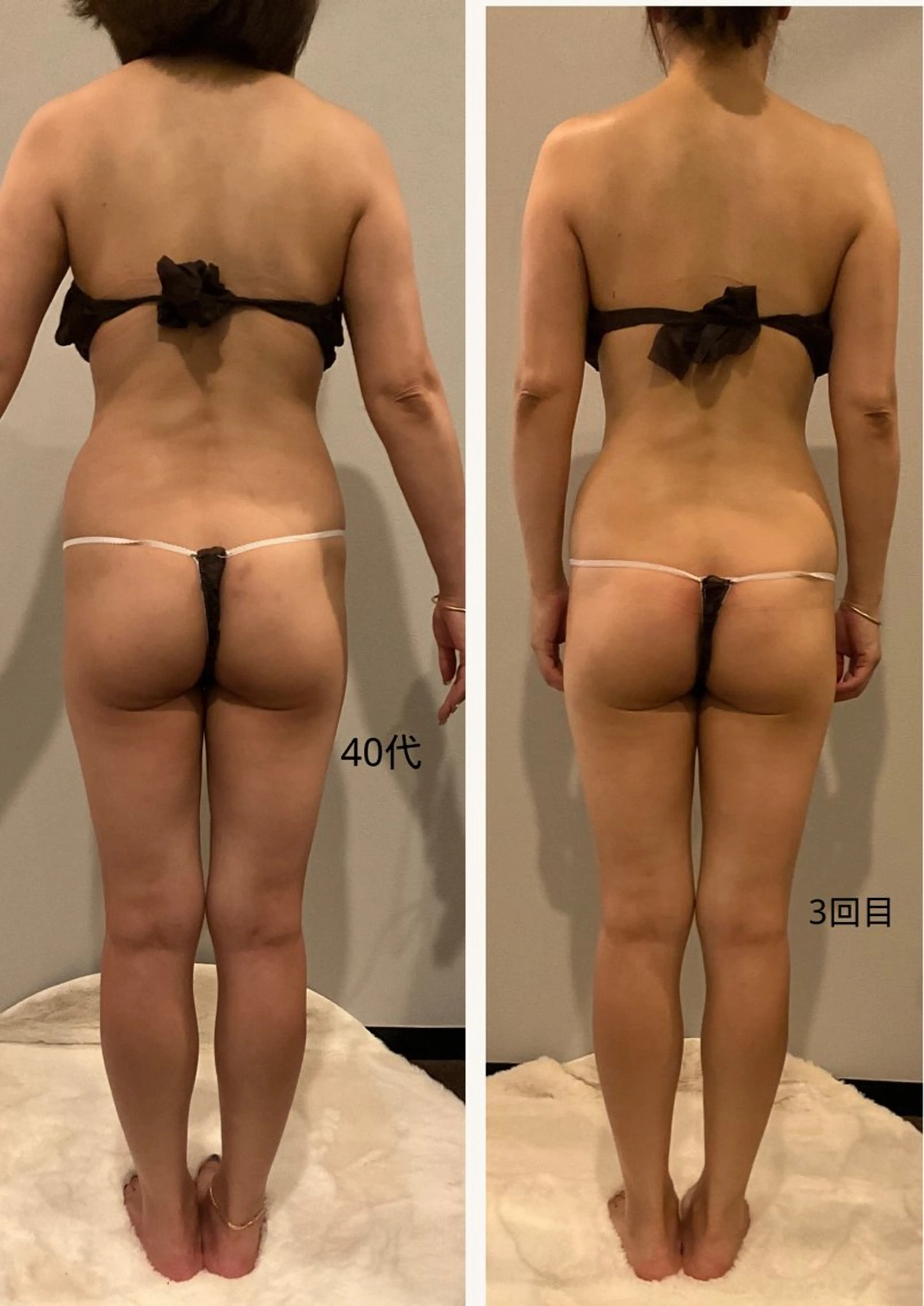 エステ リラク ✨痩身 ✨ハイパーナイフEXのエステ・リラクイメージ