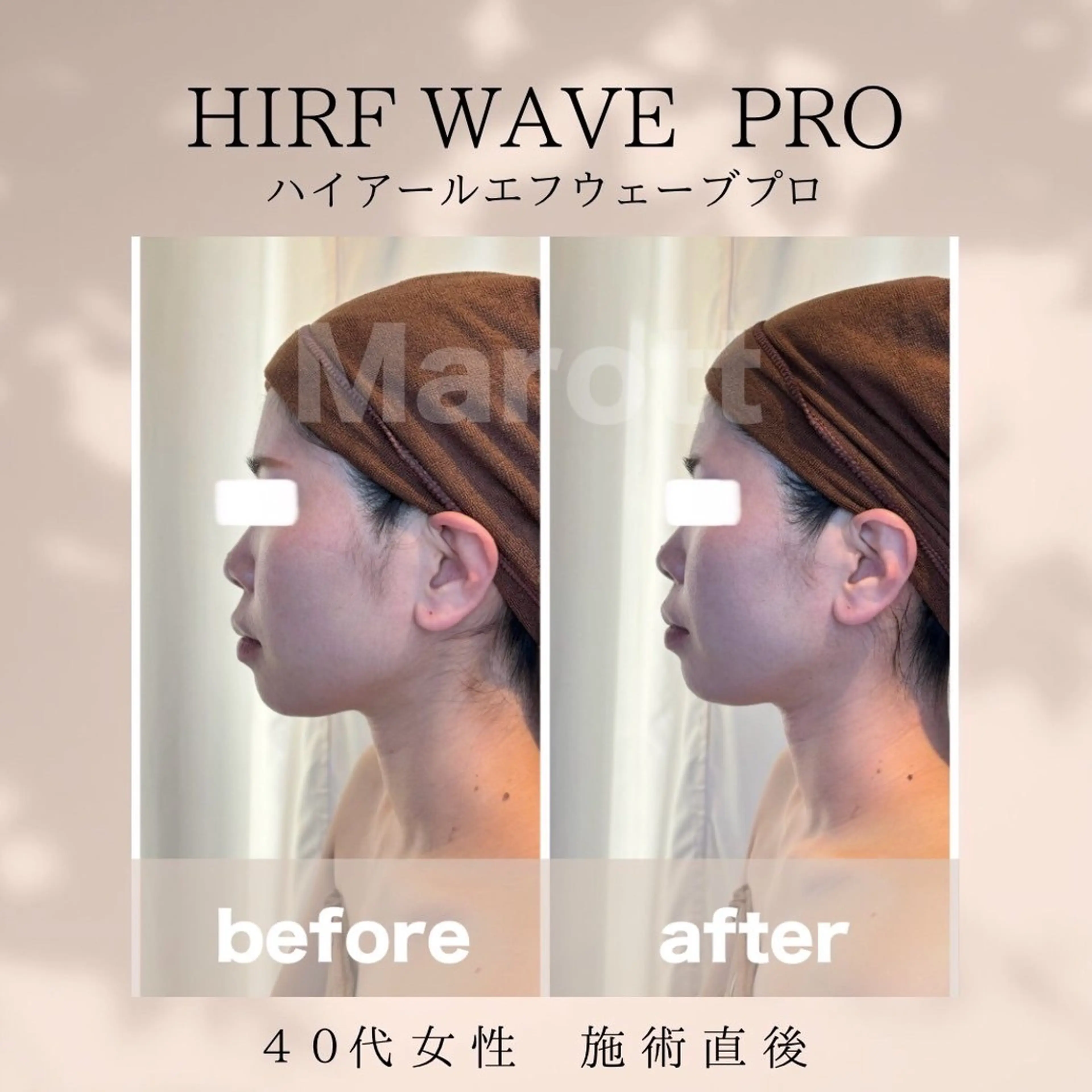 小顔サロン Marottのエステ・リラクイメージ