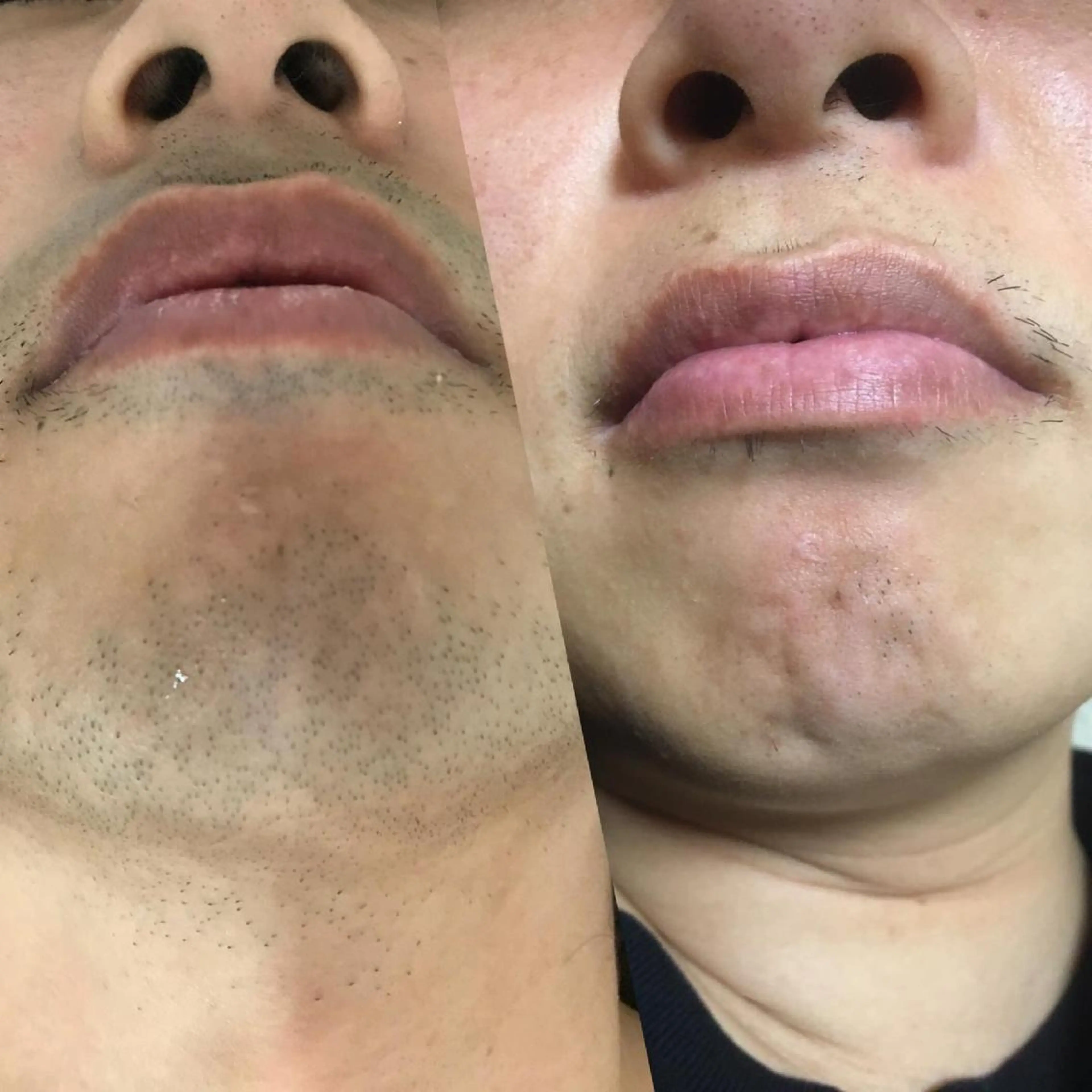 メンズ ネイル・脱毛サロンplage所属・脱毛サロン Plageプラージュのエステ・リラクイメージ