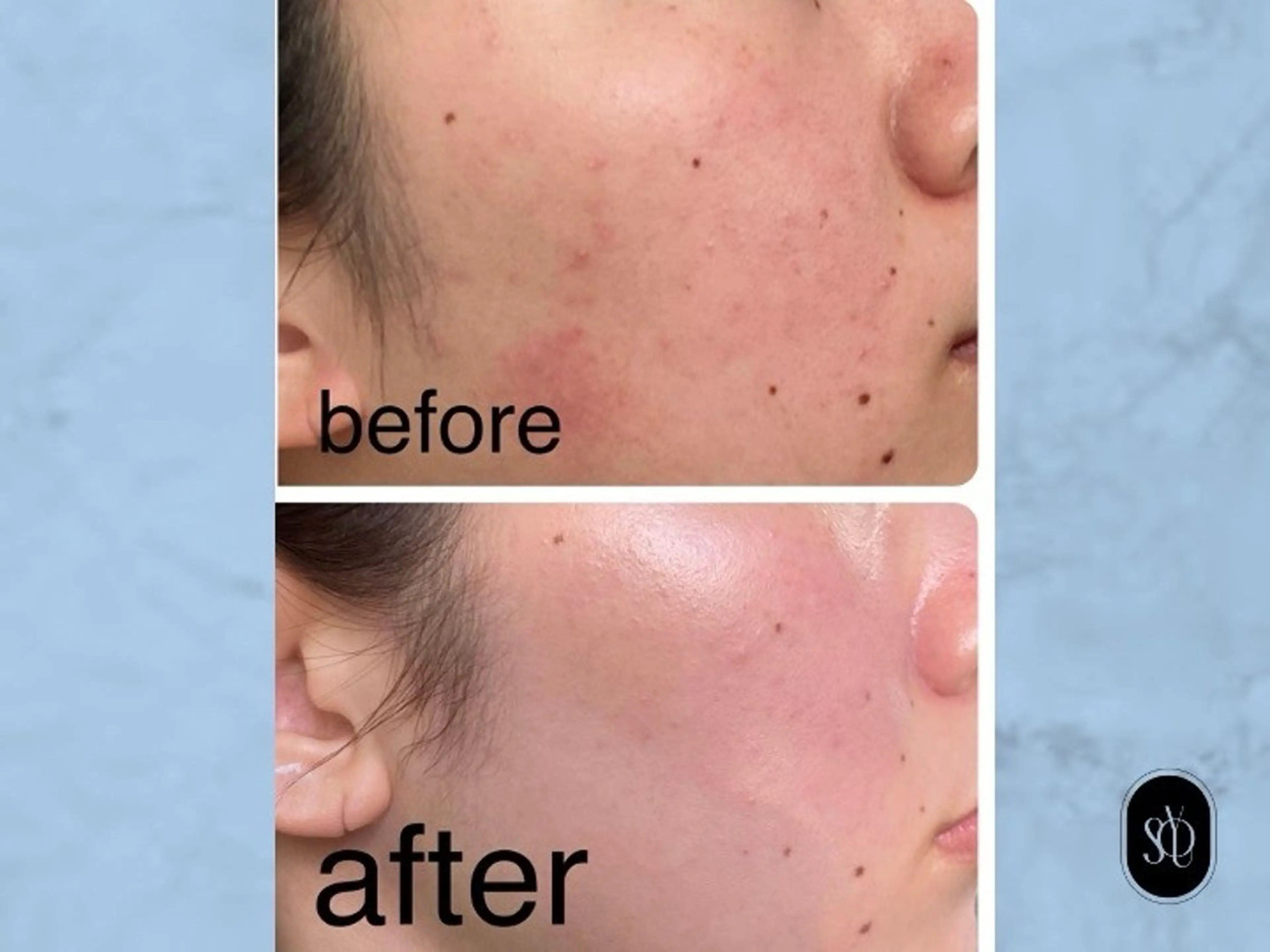 SOYOU所属・岡崎🦋SOYOU 韓国肌管理のエステ・リラクイメージ