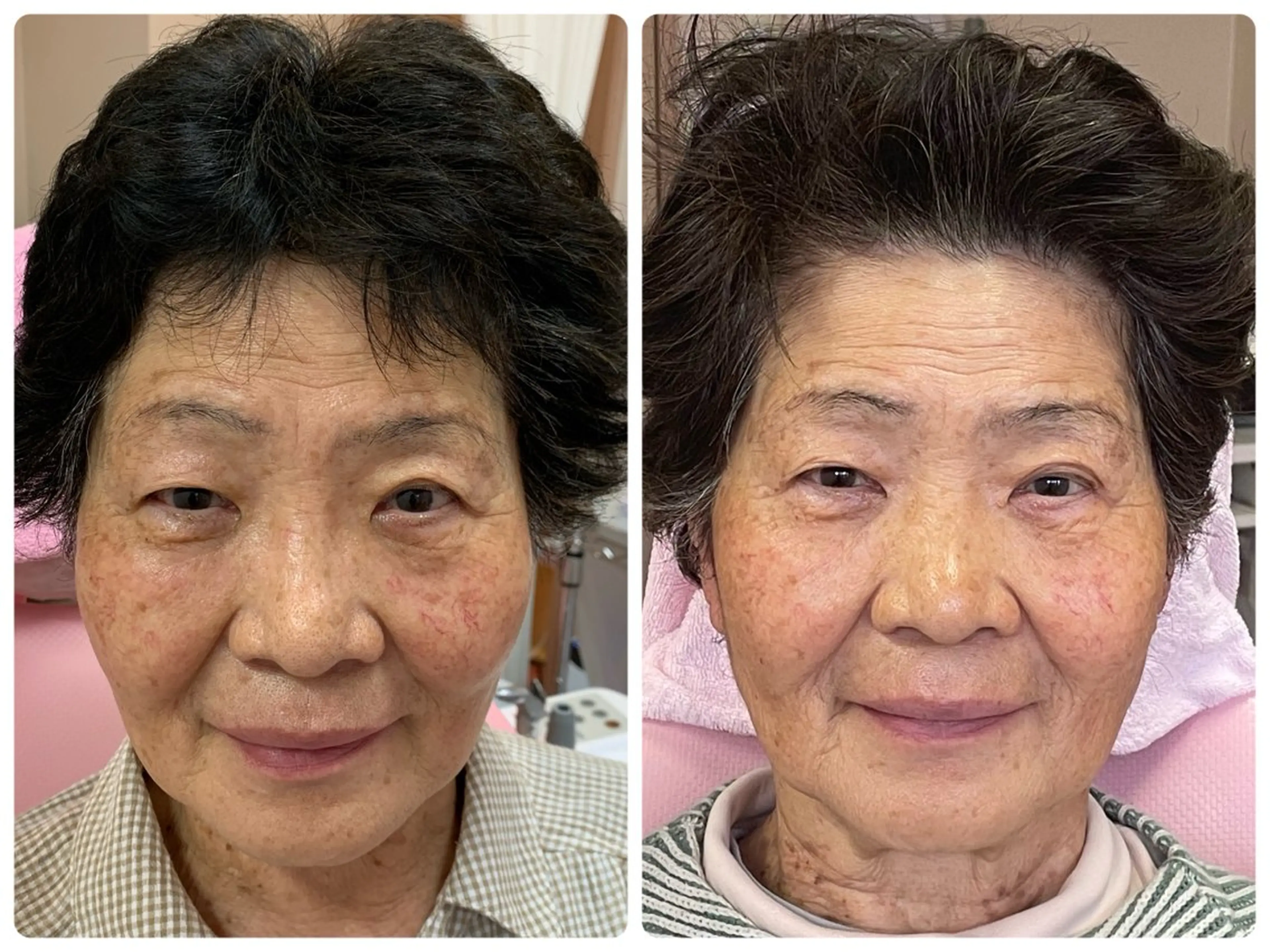 Salon Rion所属・Rion 野々村のエステ・リラクイメージ