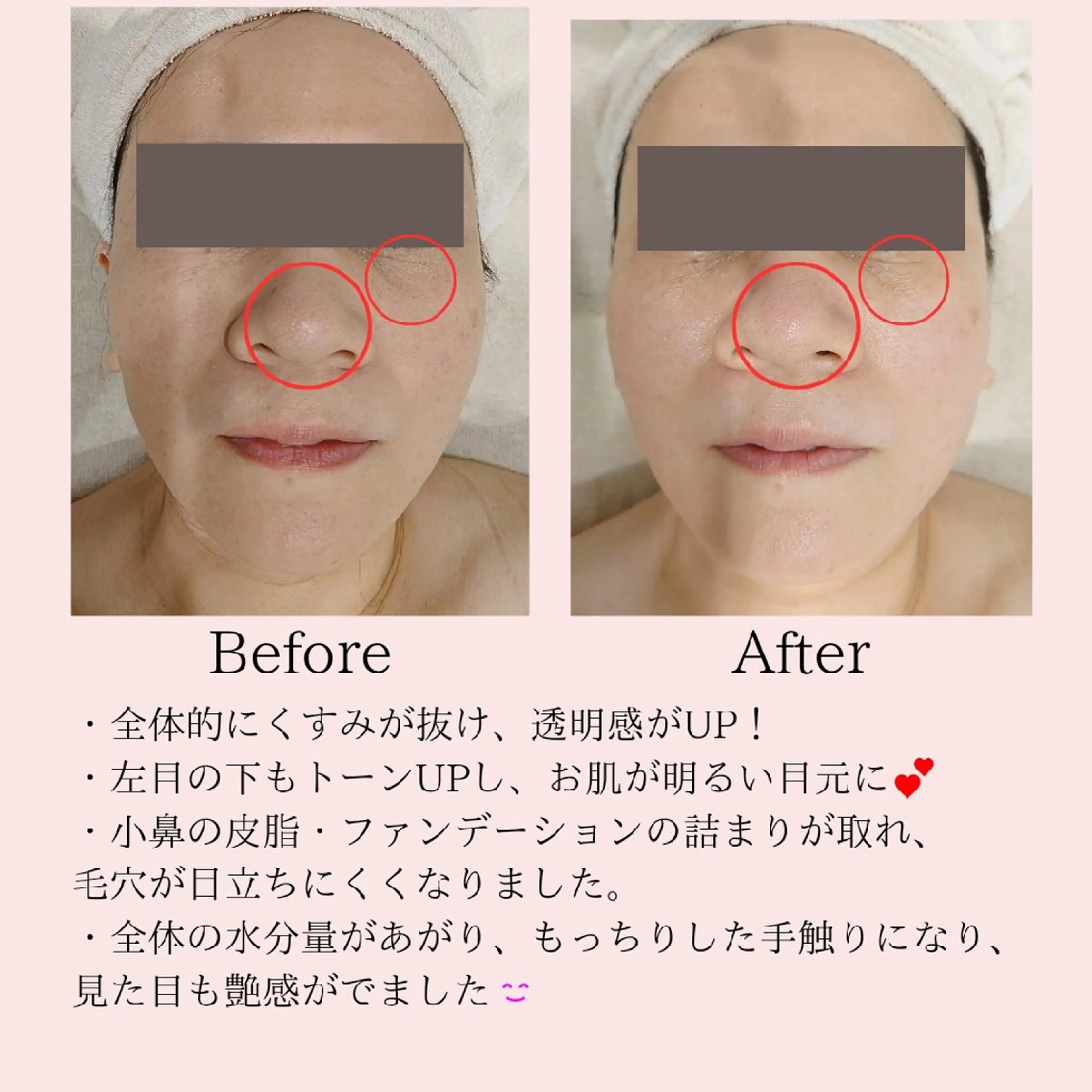 エステ PRETTIEST SHINE所属・フェイシャル/ボディ /ブライダル山田浩子のエステ・リラクイメージ