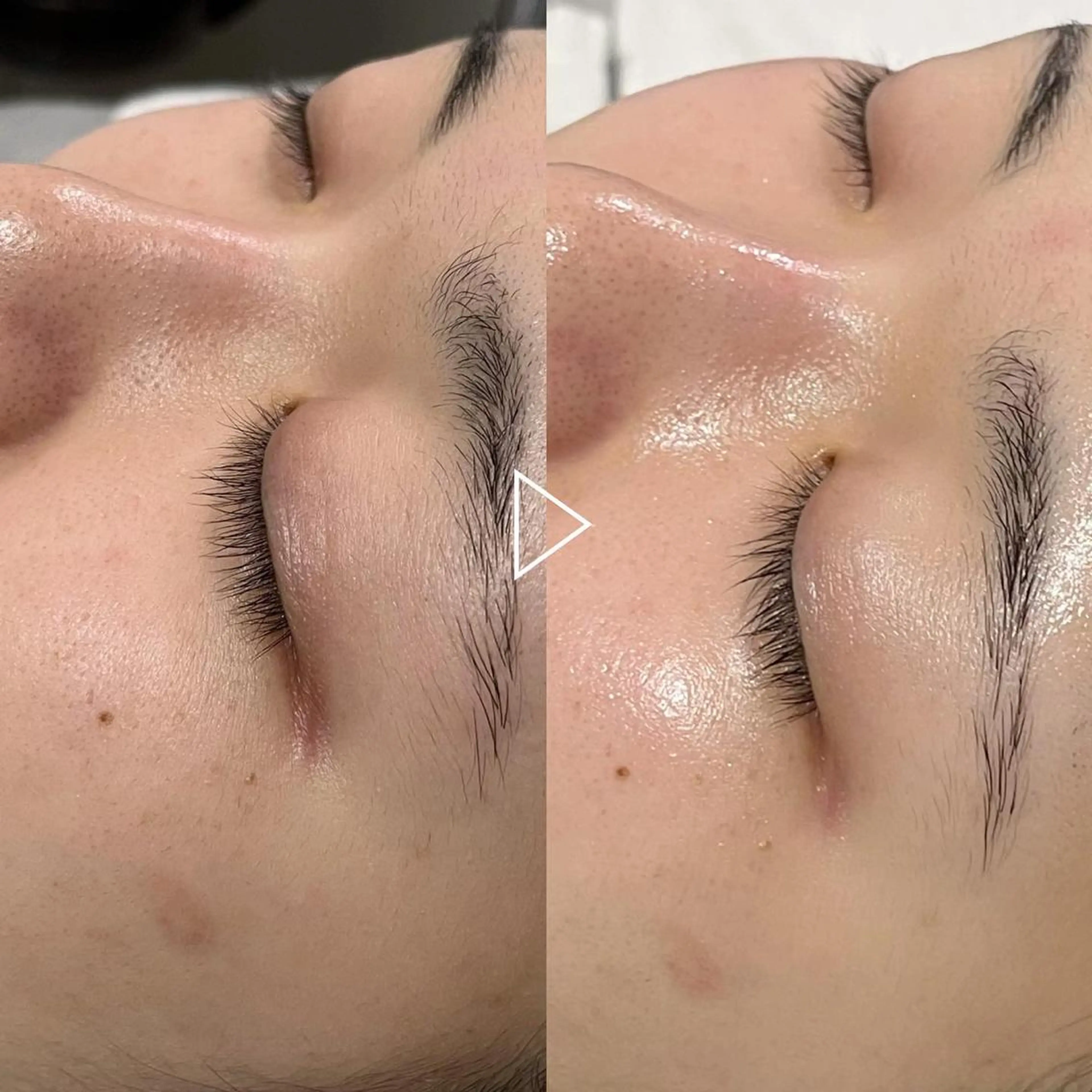 【ご新規様限定】【2回で5,500円】肌質改善フェイシャルエステの写真