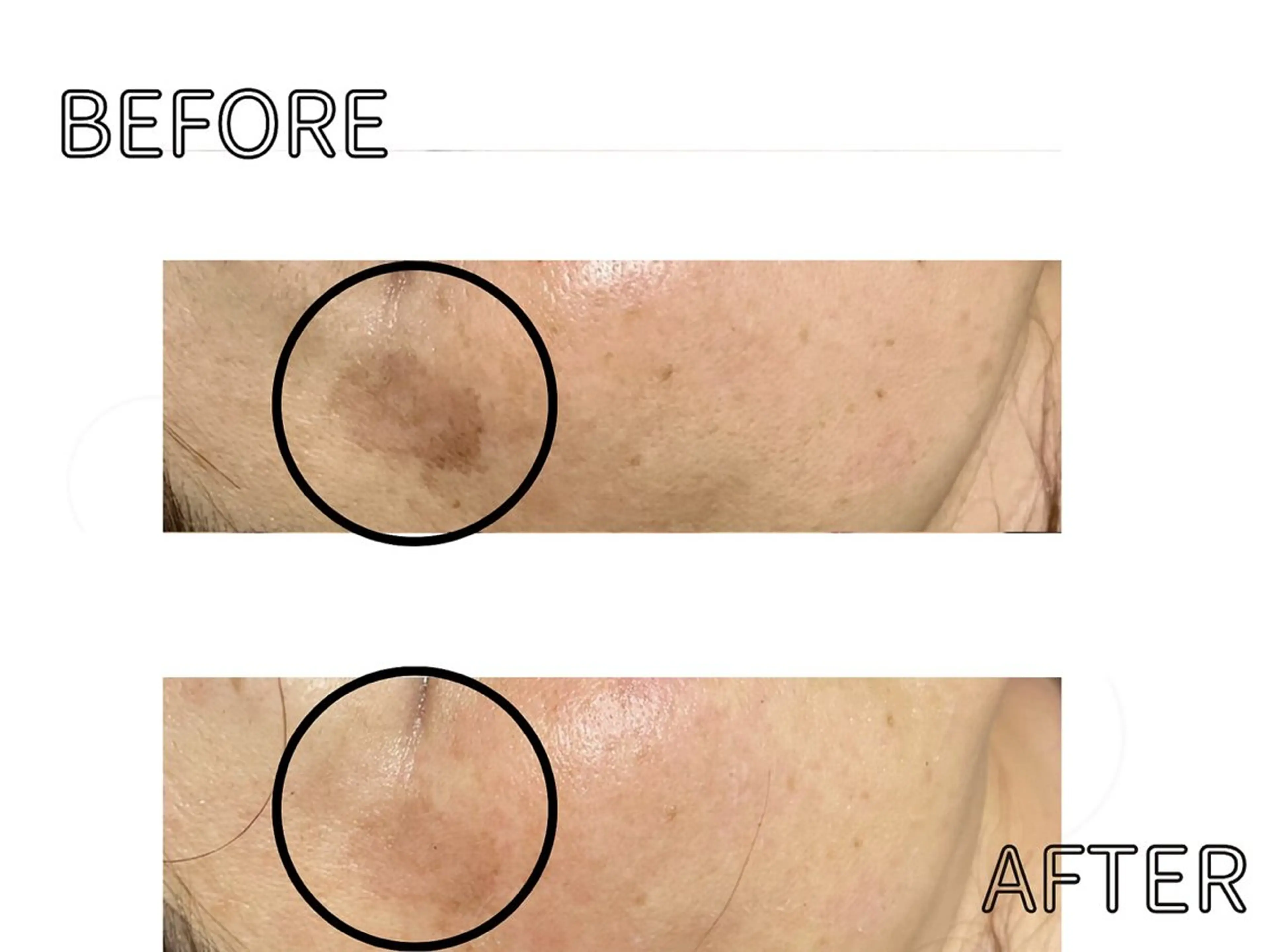 ハーブピーリング LIME池袋東口のエステ・リラクイメージ