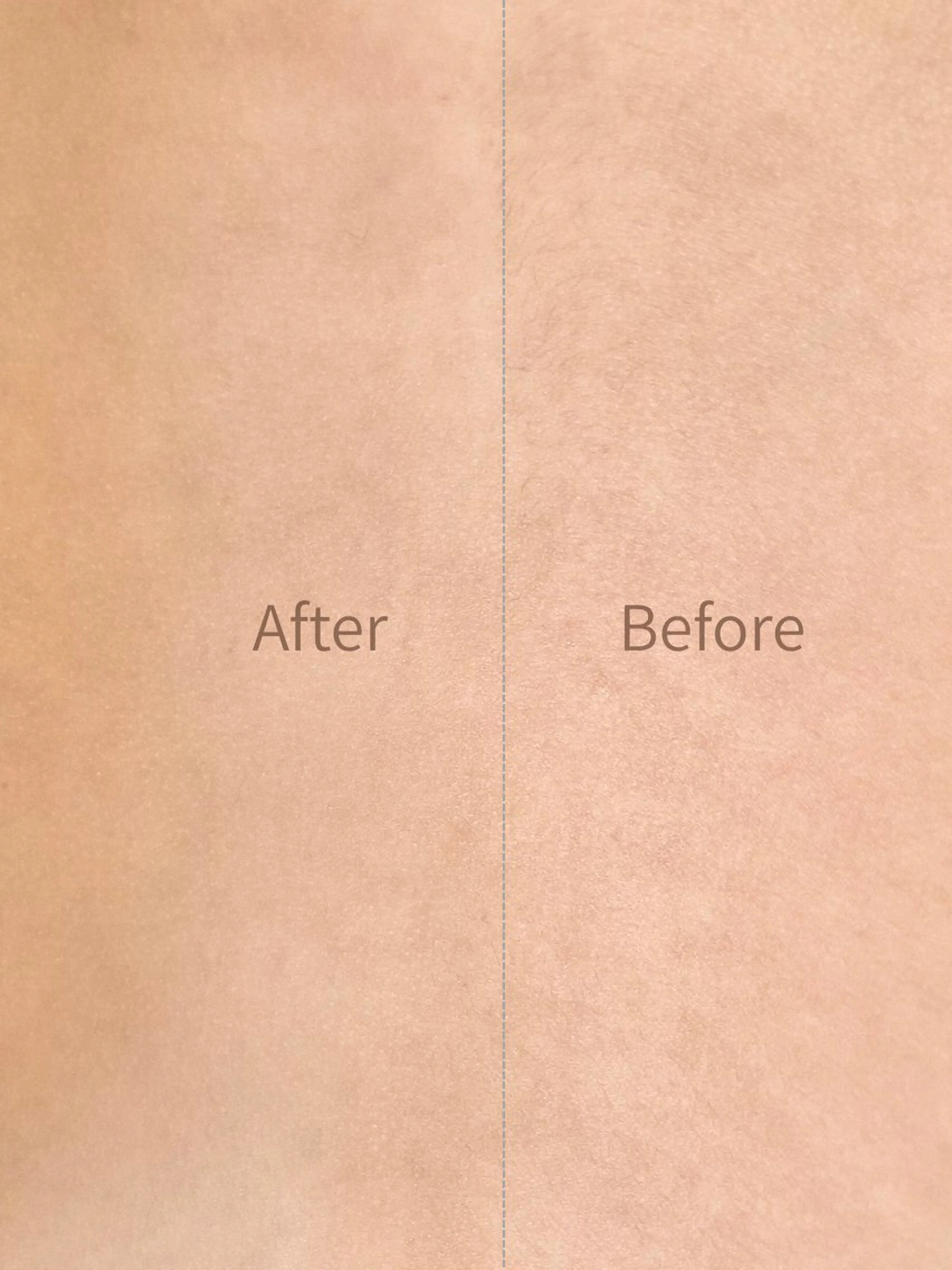 脱毛 hug me. シュガーリングサロンのエステ・リラクイメージ