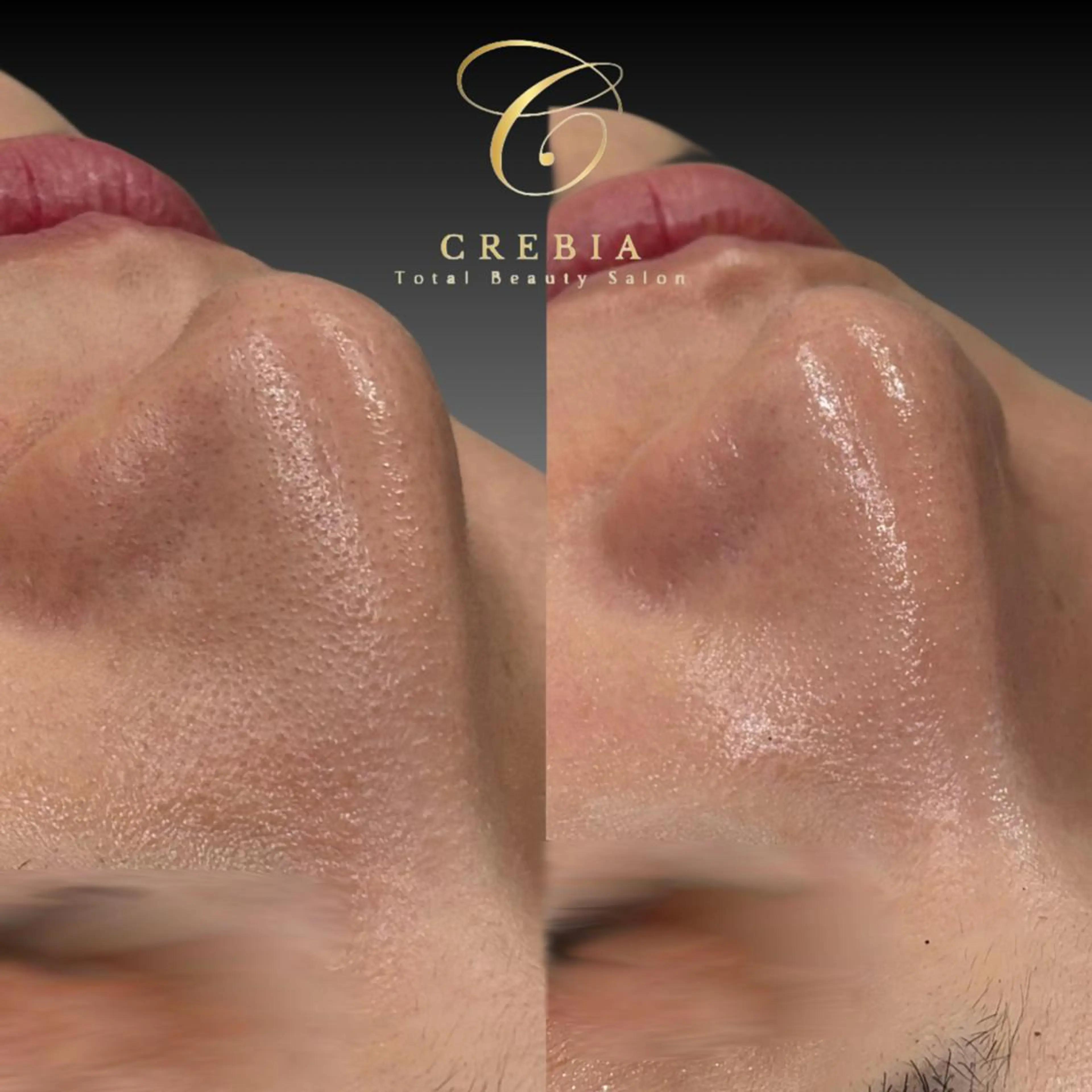 心斎橋🤍堀江.小顔 ハーブ.痩身クレビアのエステ・リラクイメージ