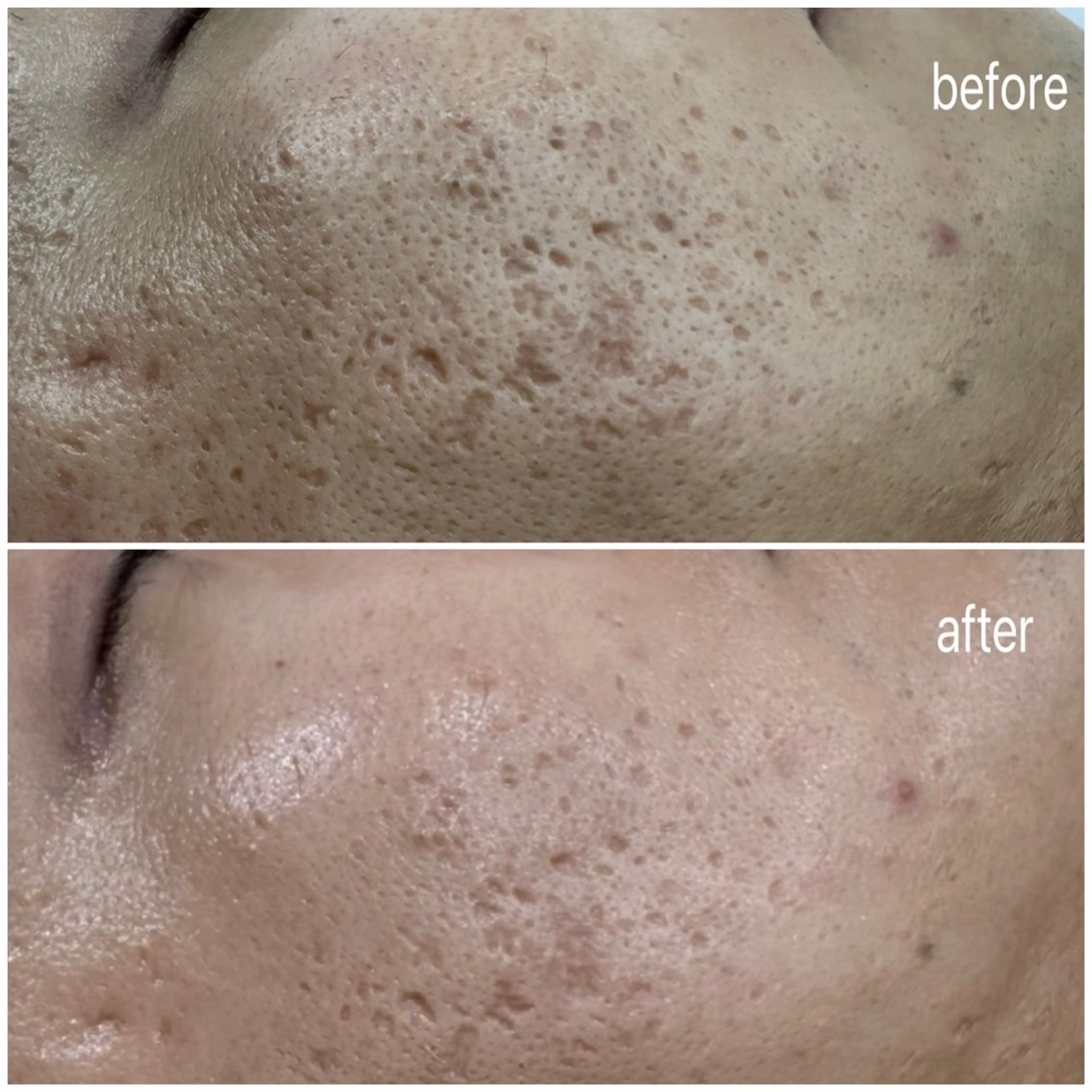 skinity所属・ピーリング専門サロン skinityのエステ・リラクイメージ