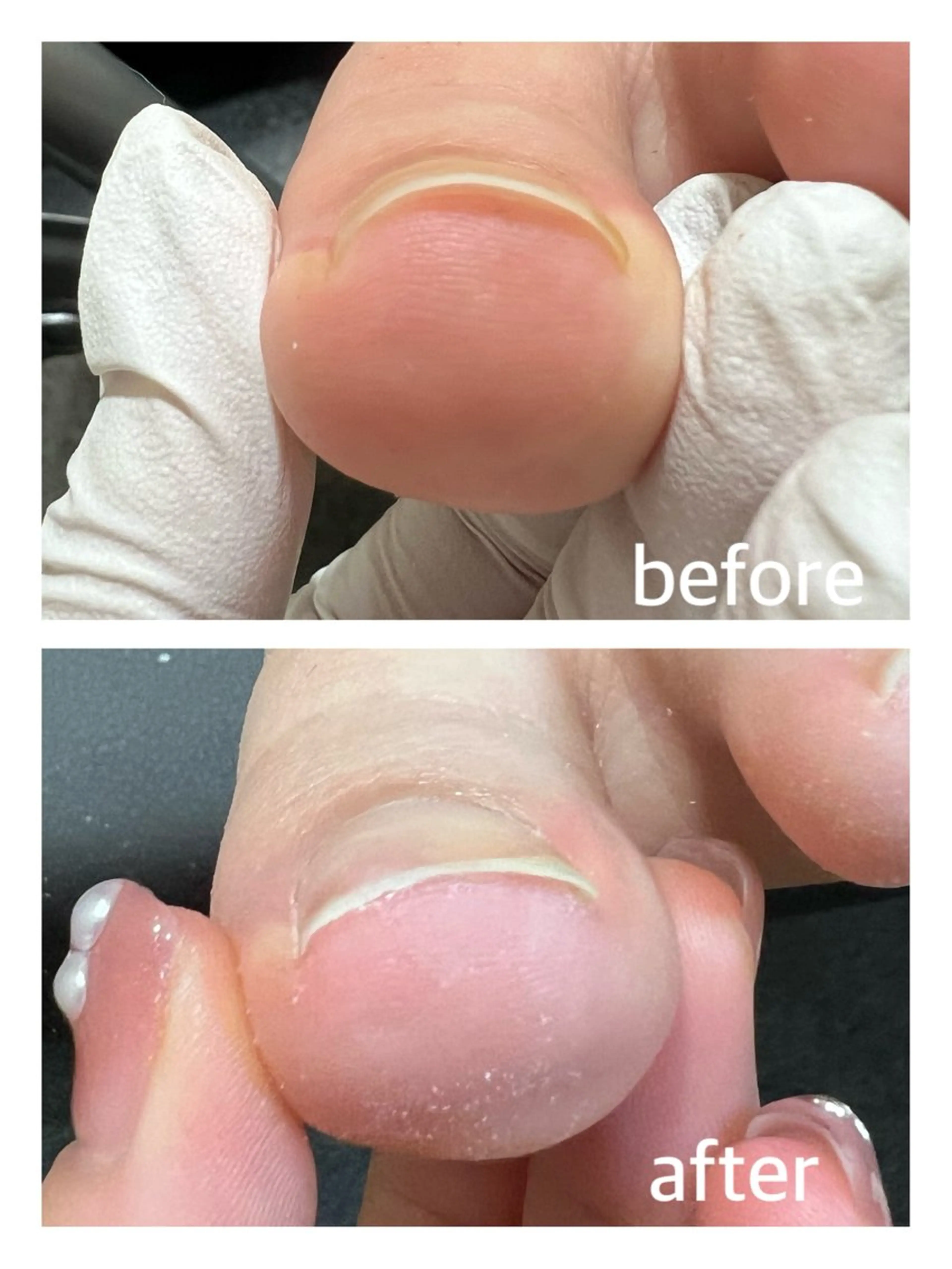 ネイル 巻き爪補正店 堺東店のネイルデザイン