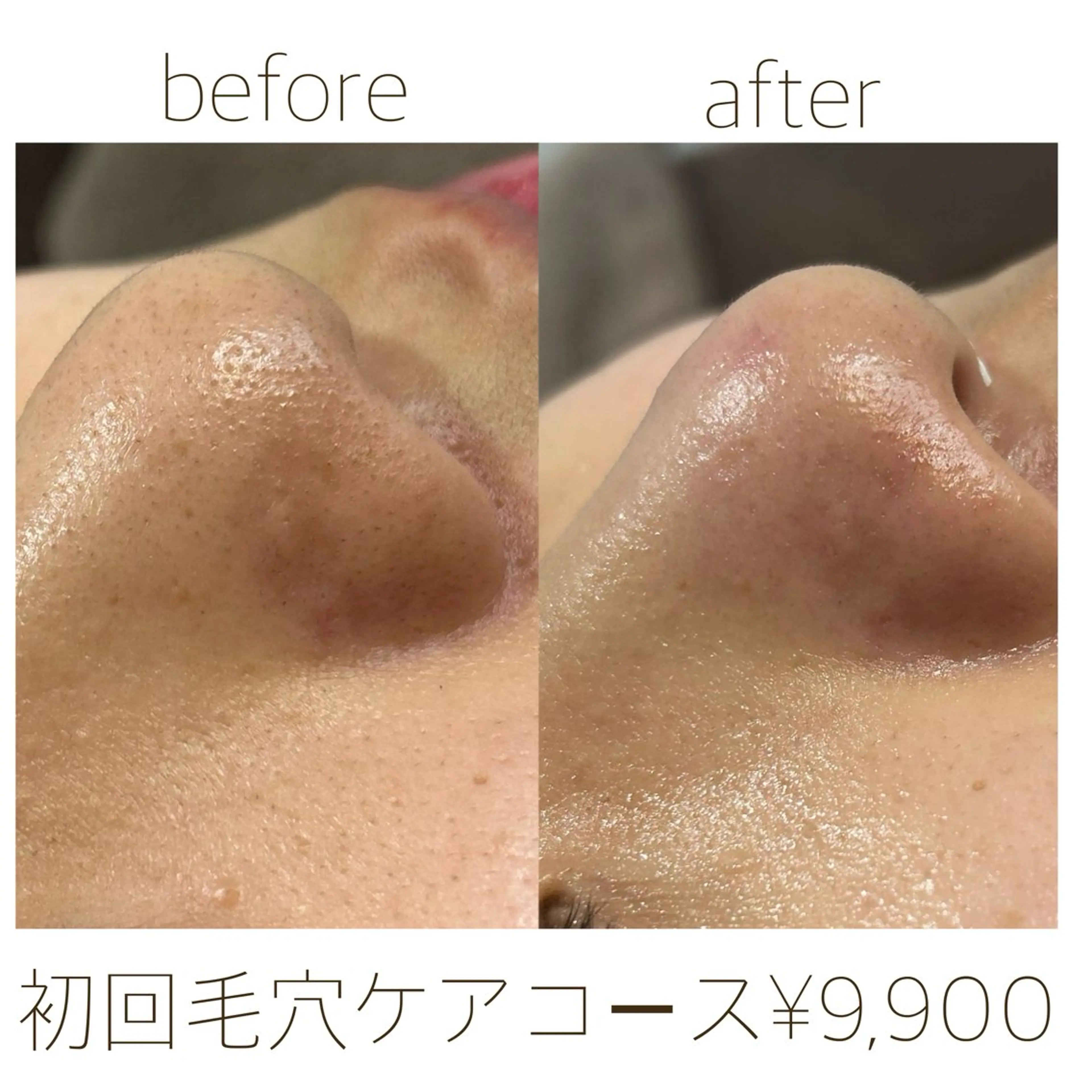 田辺🌿毛穴ケア サロンリテルナのエステ・リラクイメージ