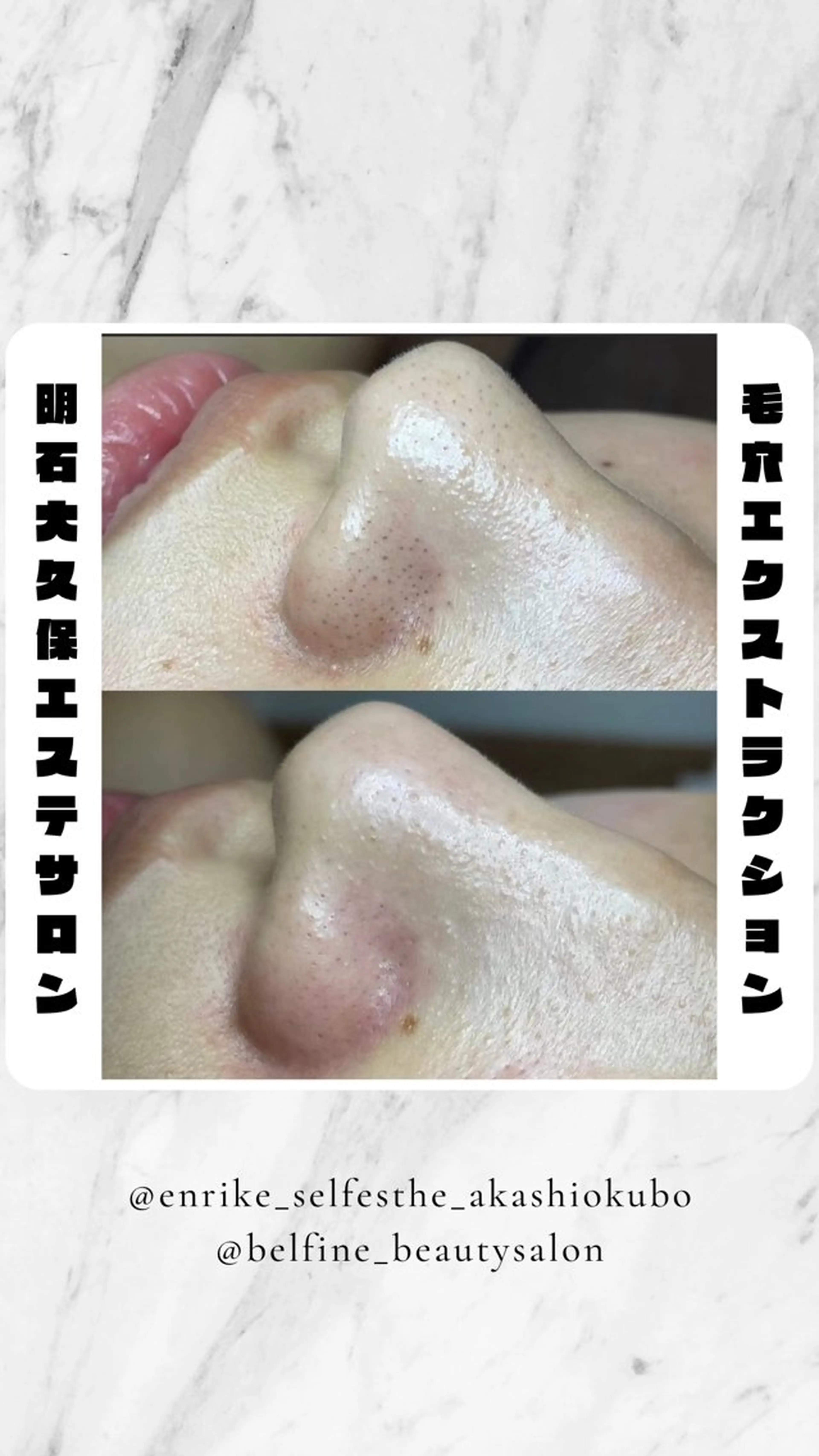 セルフエステエンリケ明石大久保店所属・夕希リンパ&痩身& 脱毛&毛穴ケアのエステ・リラクイメージ