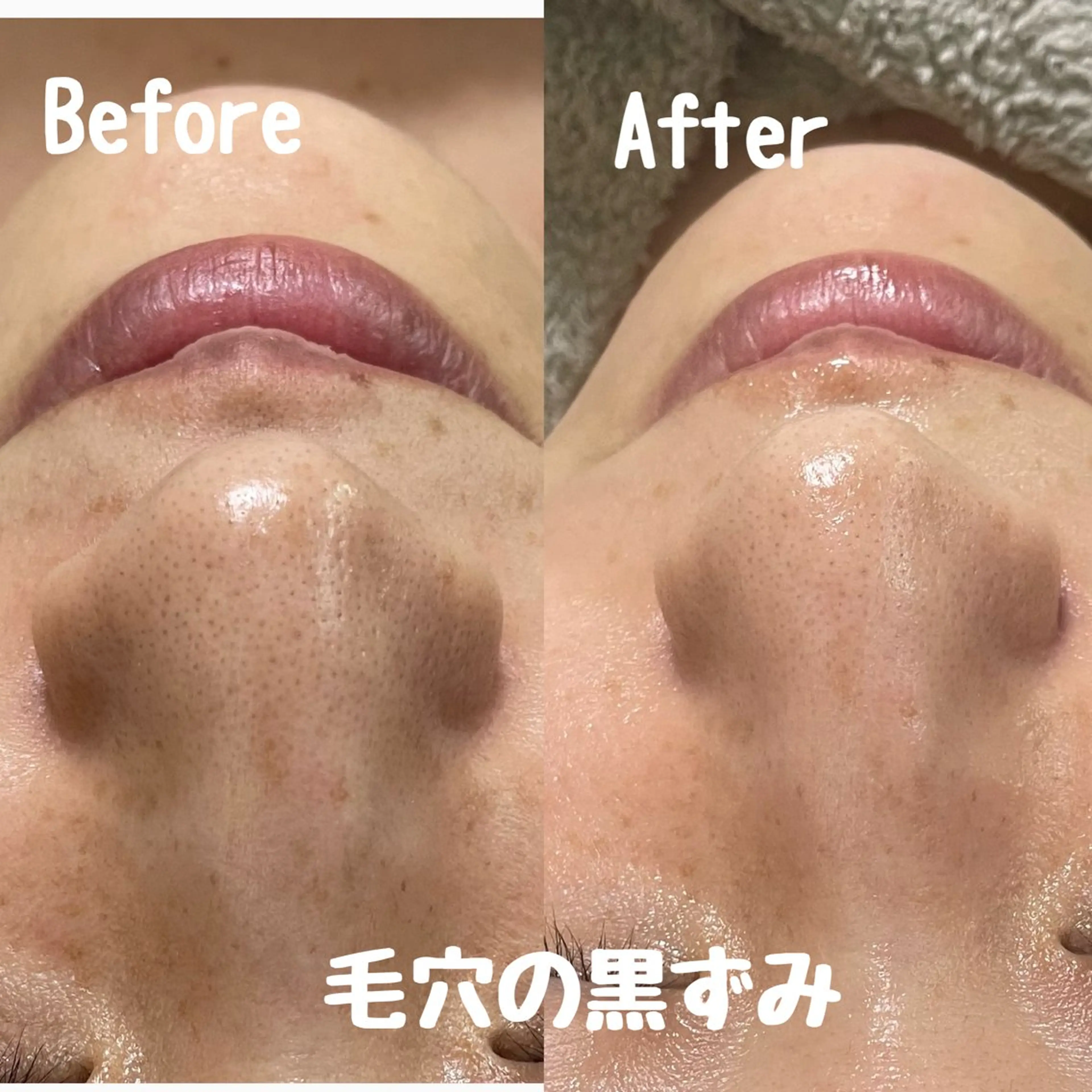 エステ リラク Surien 水脇ゆうのその他イメージ