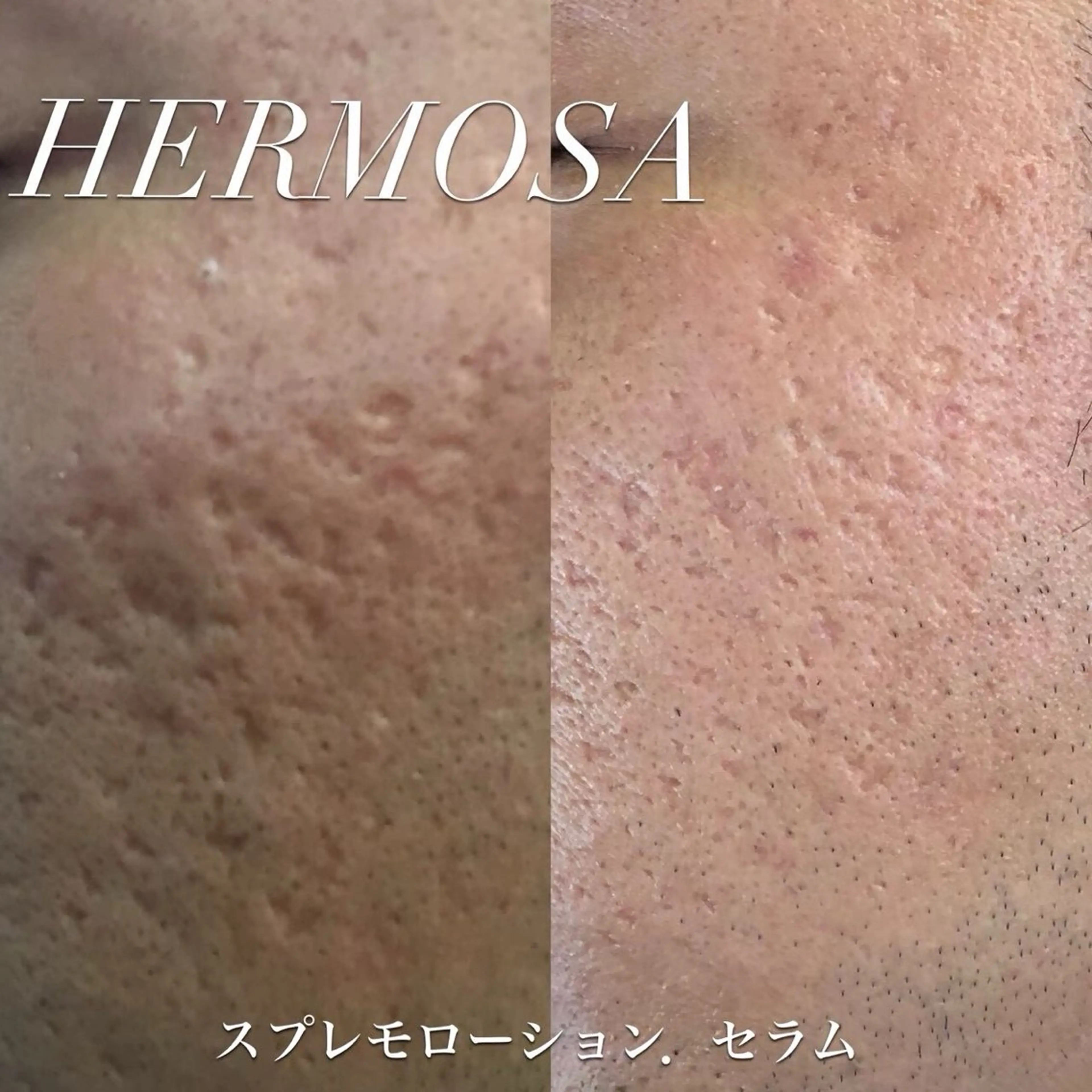 オールハンド フェイシャルのエステ・リラクイメージ