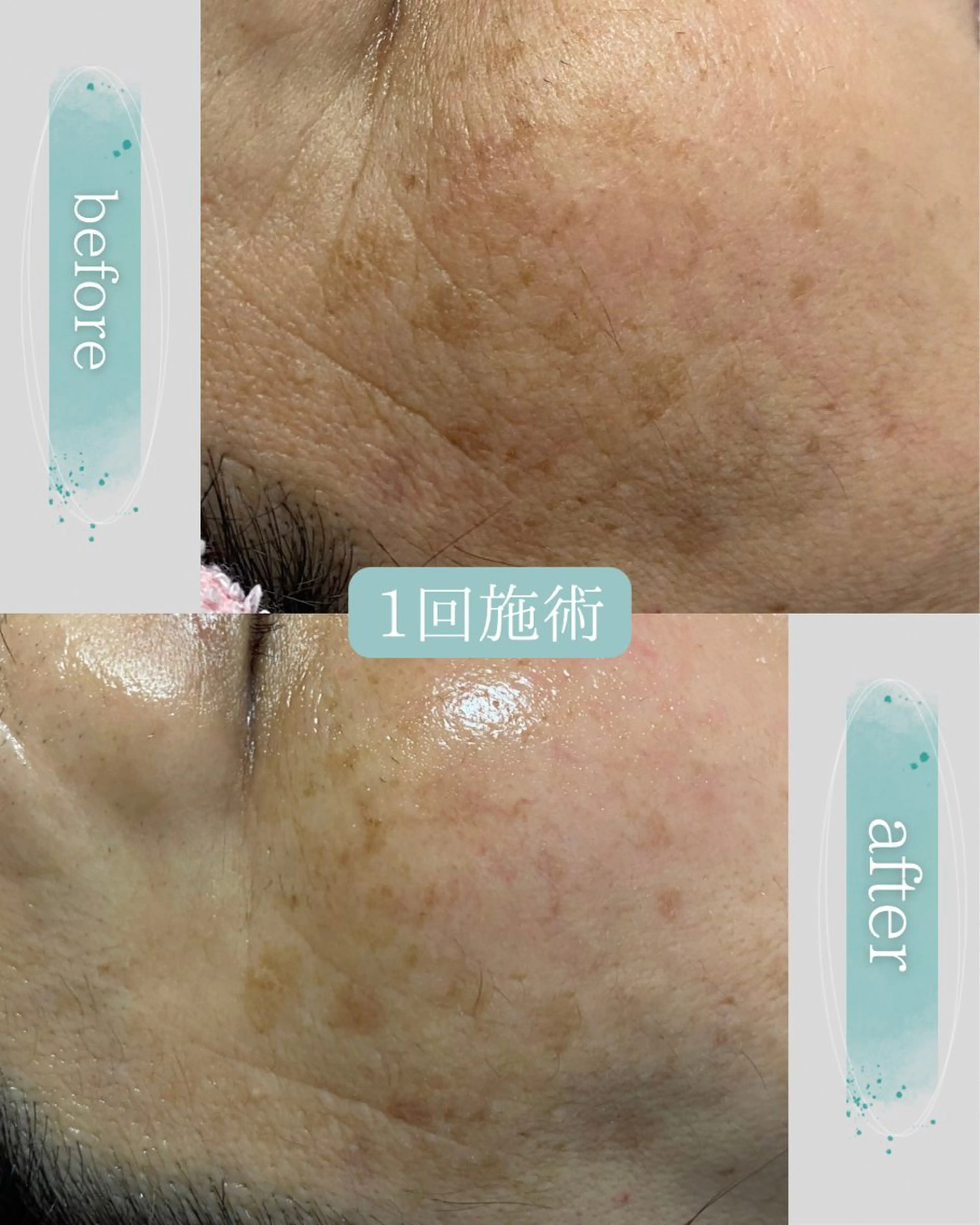 Life＆ Beautifulのエステ・リラクイメージ