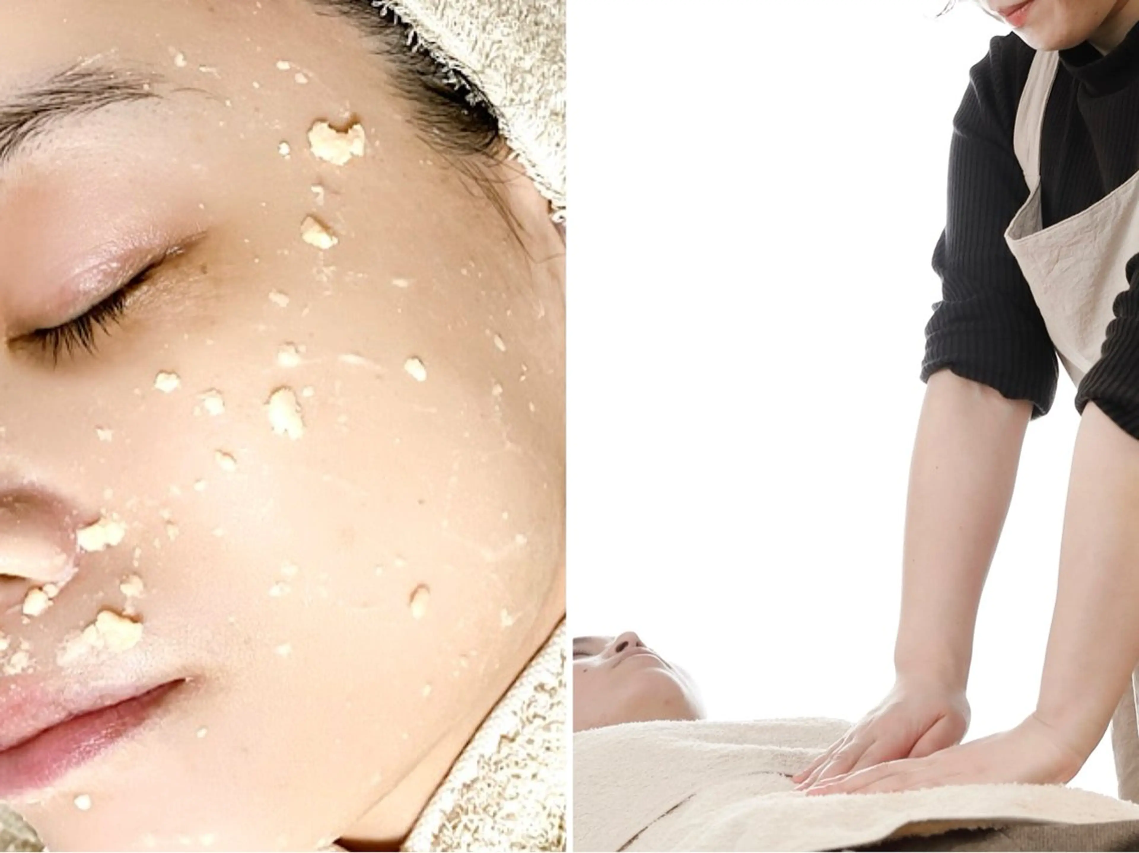 ニキビケア/毛穴/ 赤み/自信の肌✨森園のエステ・リラクイメージ