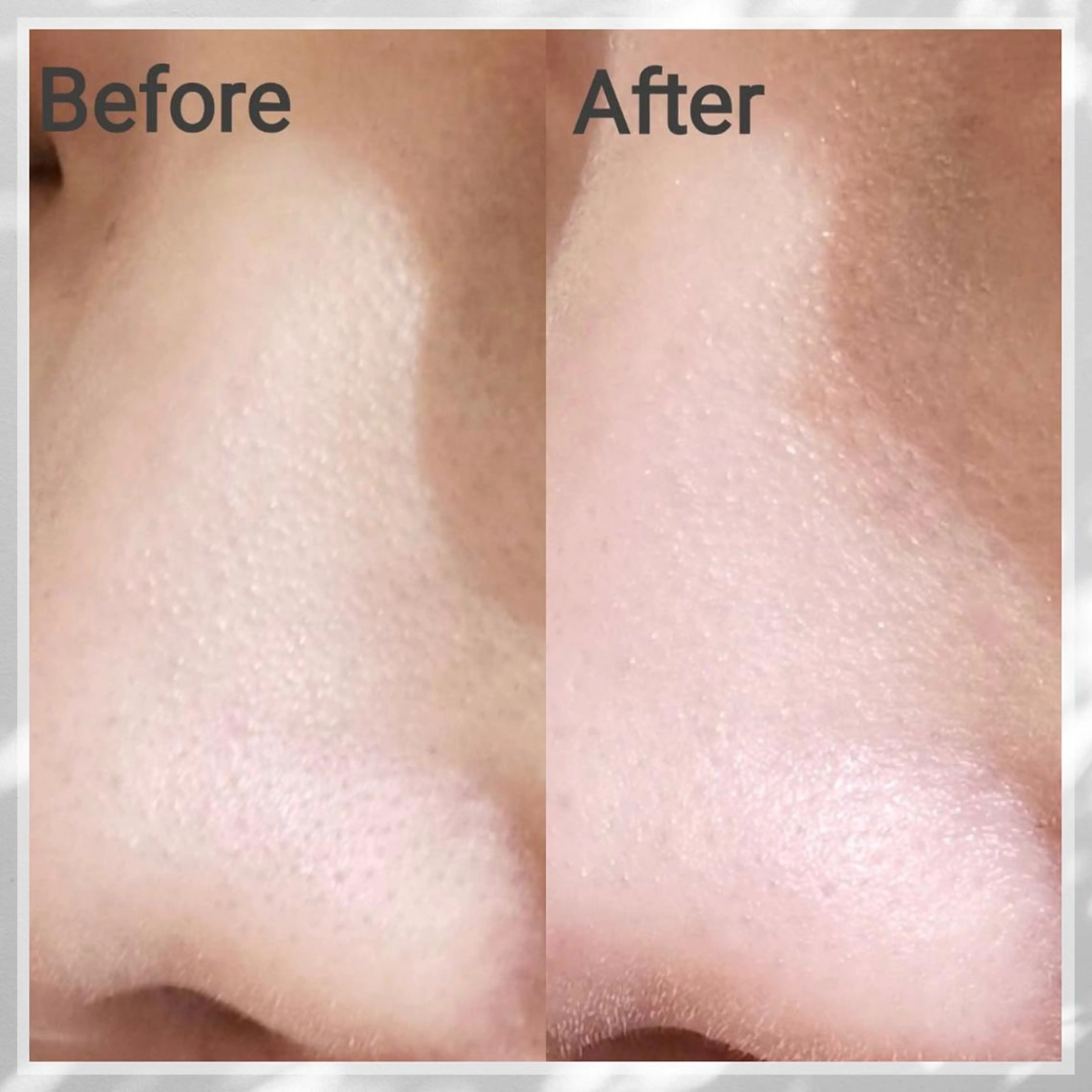 小顔・ツルツル素肌 ハリステリアのエステ・リラクイメージ