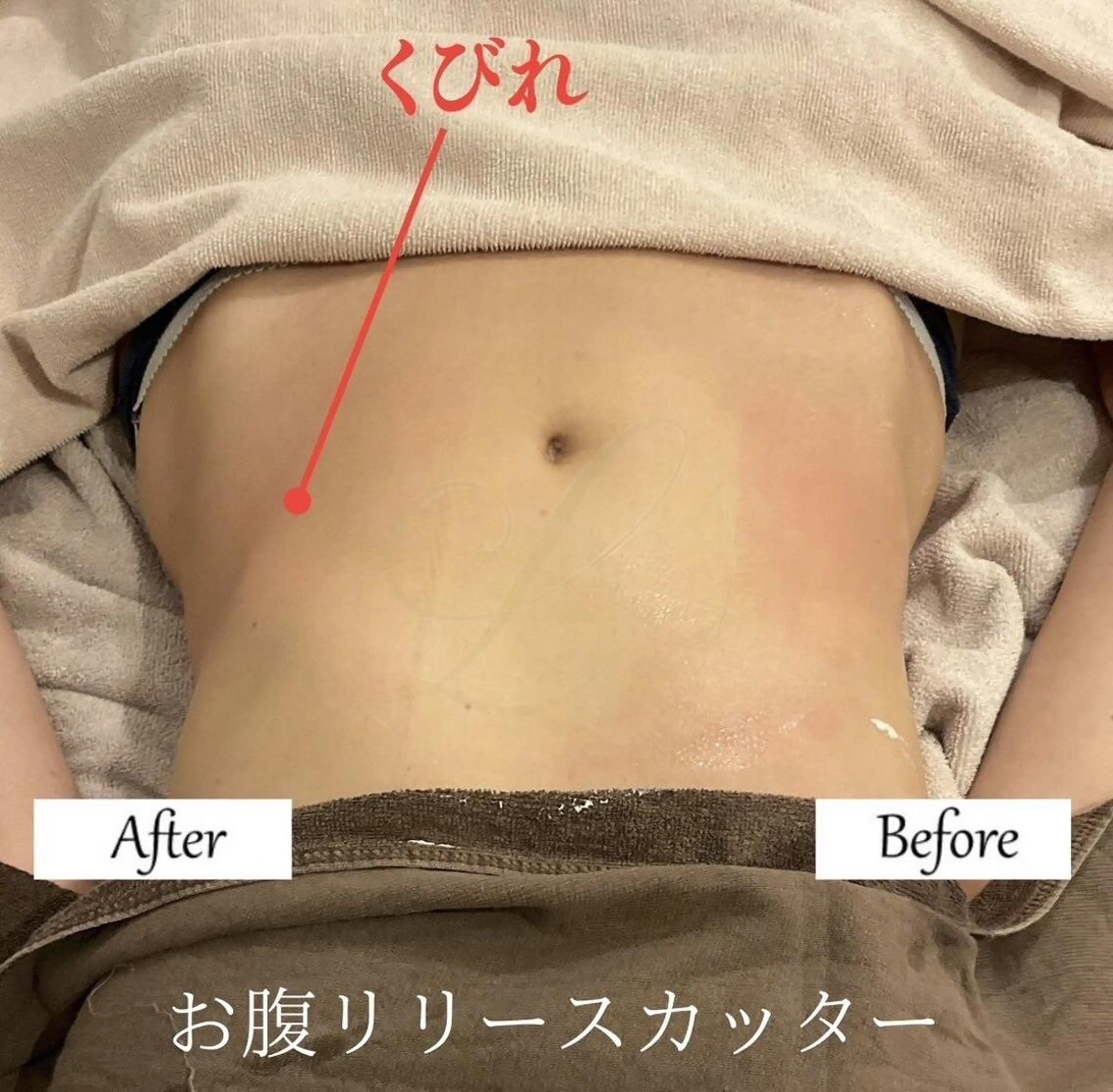 ブライダルサロン ｜Lino【堀江】のエステ・リラクイメージ