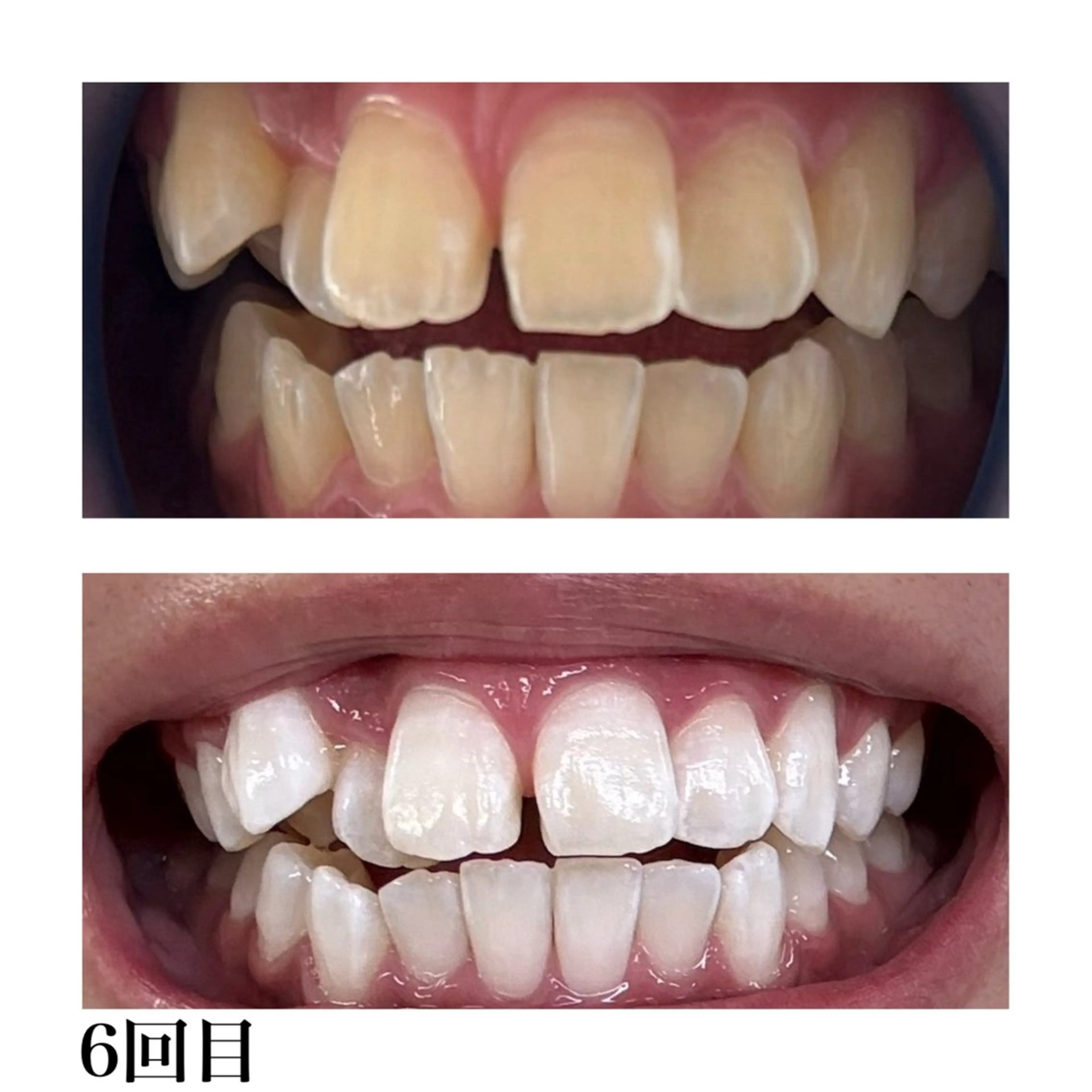 その他 ホワイトニングショップ津店所属・ホワイトニング ショップ津店のその他イメージ