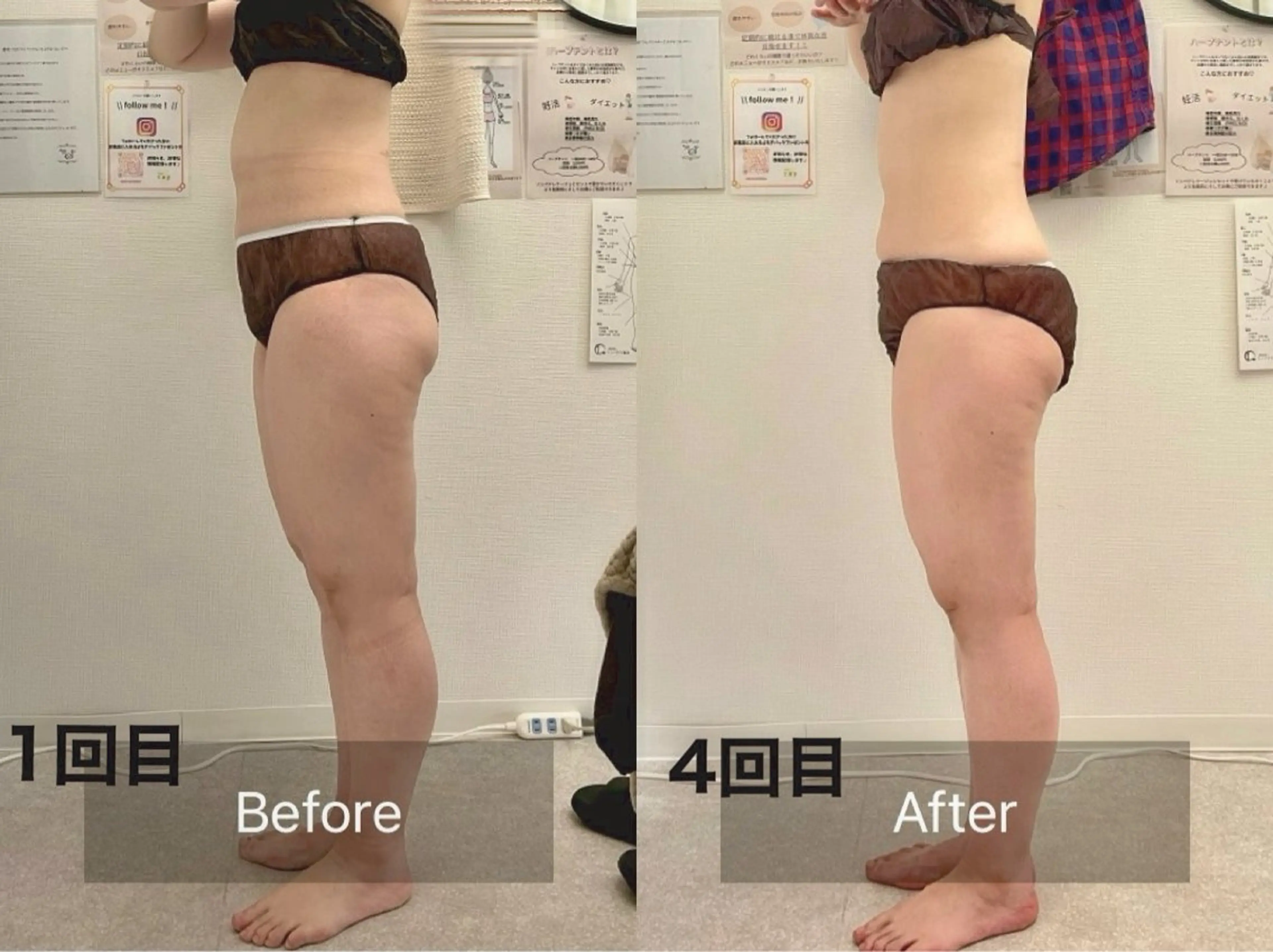 その他 salon ray 痩身／体質改善のエステ・リラクイメージ