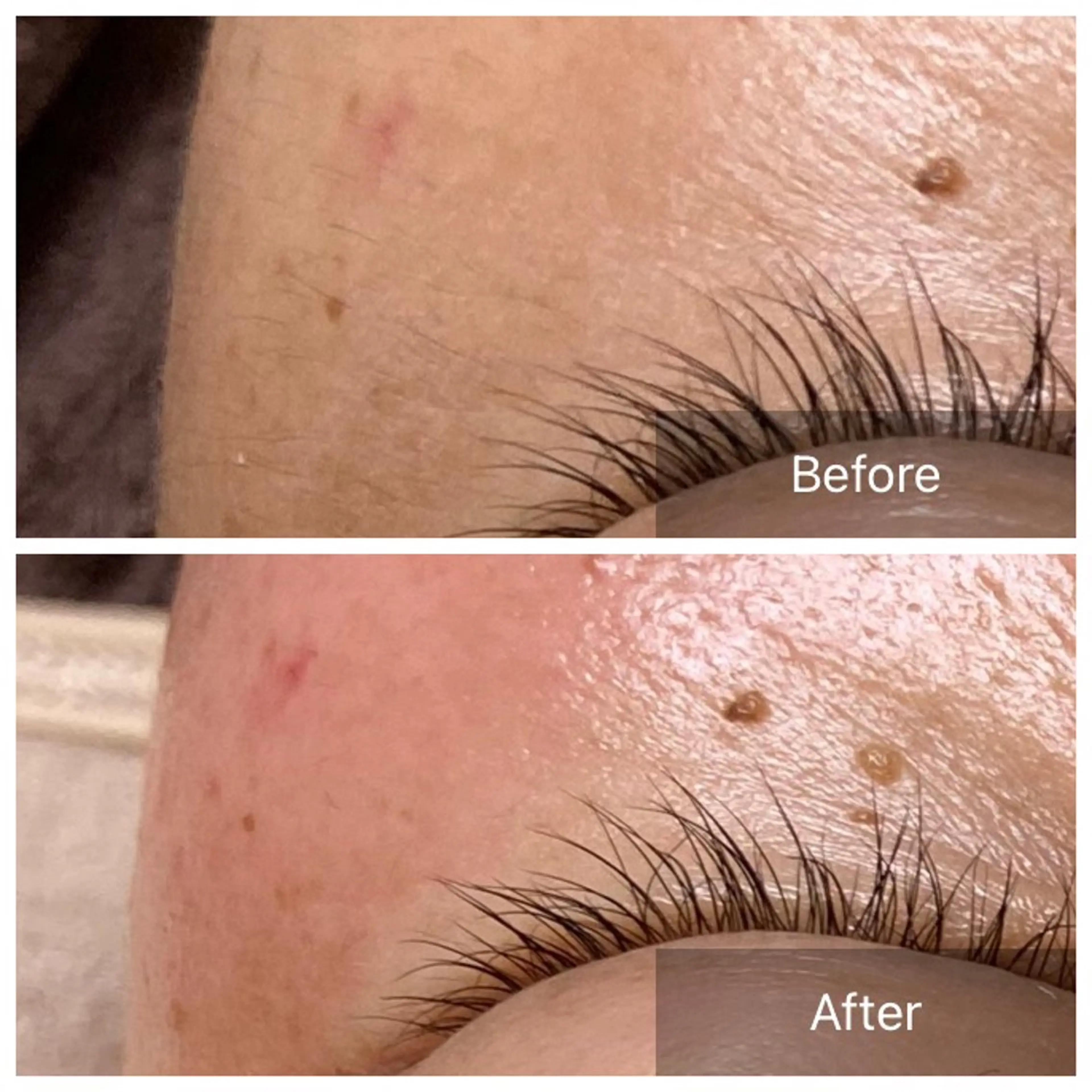 脱毛 産毛専門店 Bittoのエステ・リラクイメージ