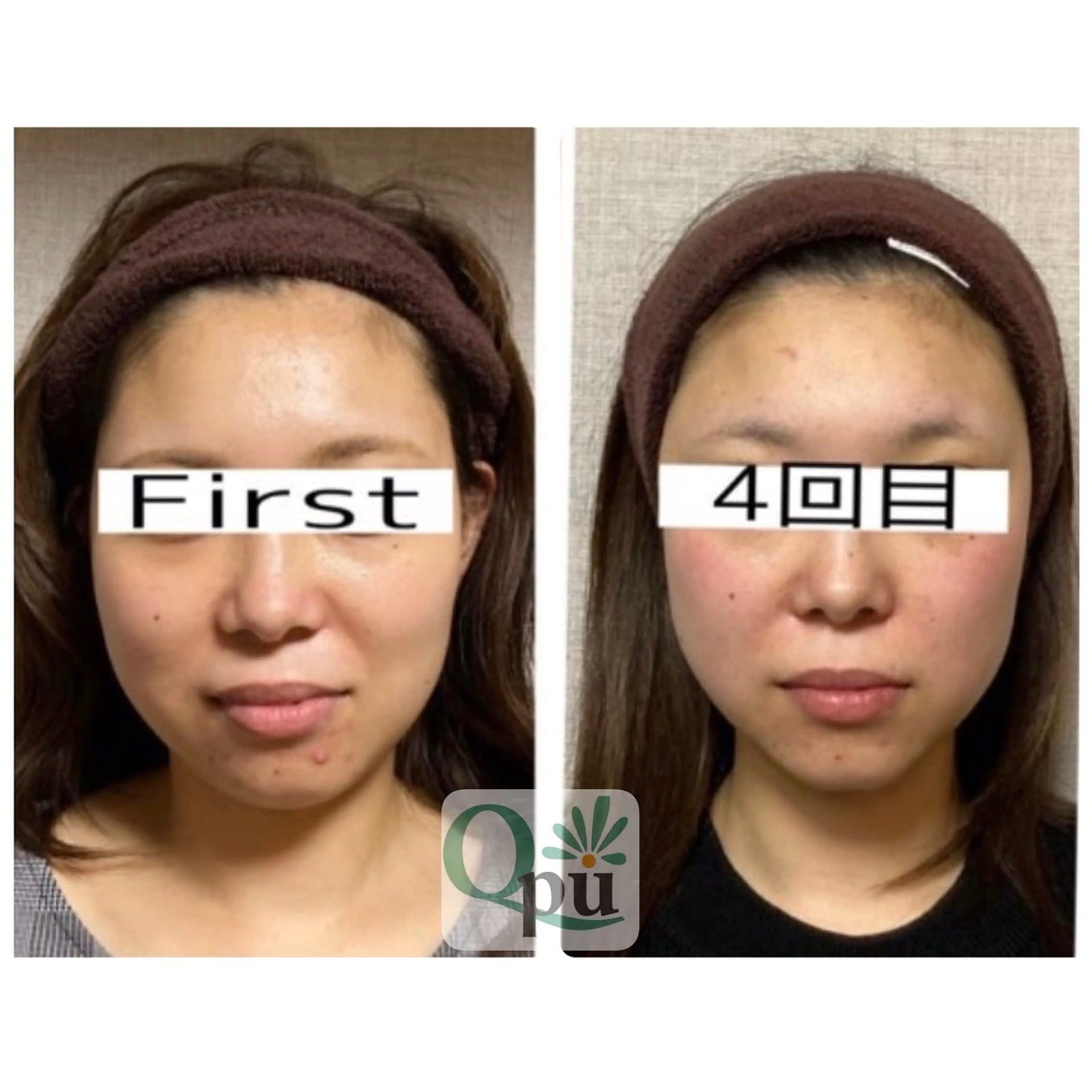 エステ リラク Qpu(キュープ)下北沢店所属・鮎川 さゆりのエステ・リラクイメージ