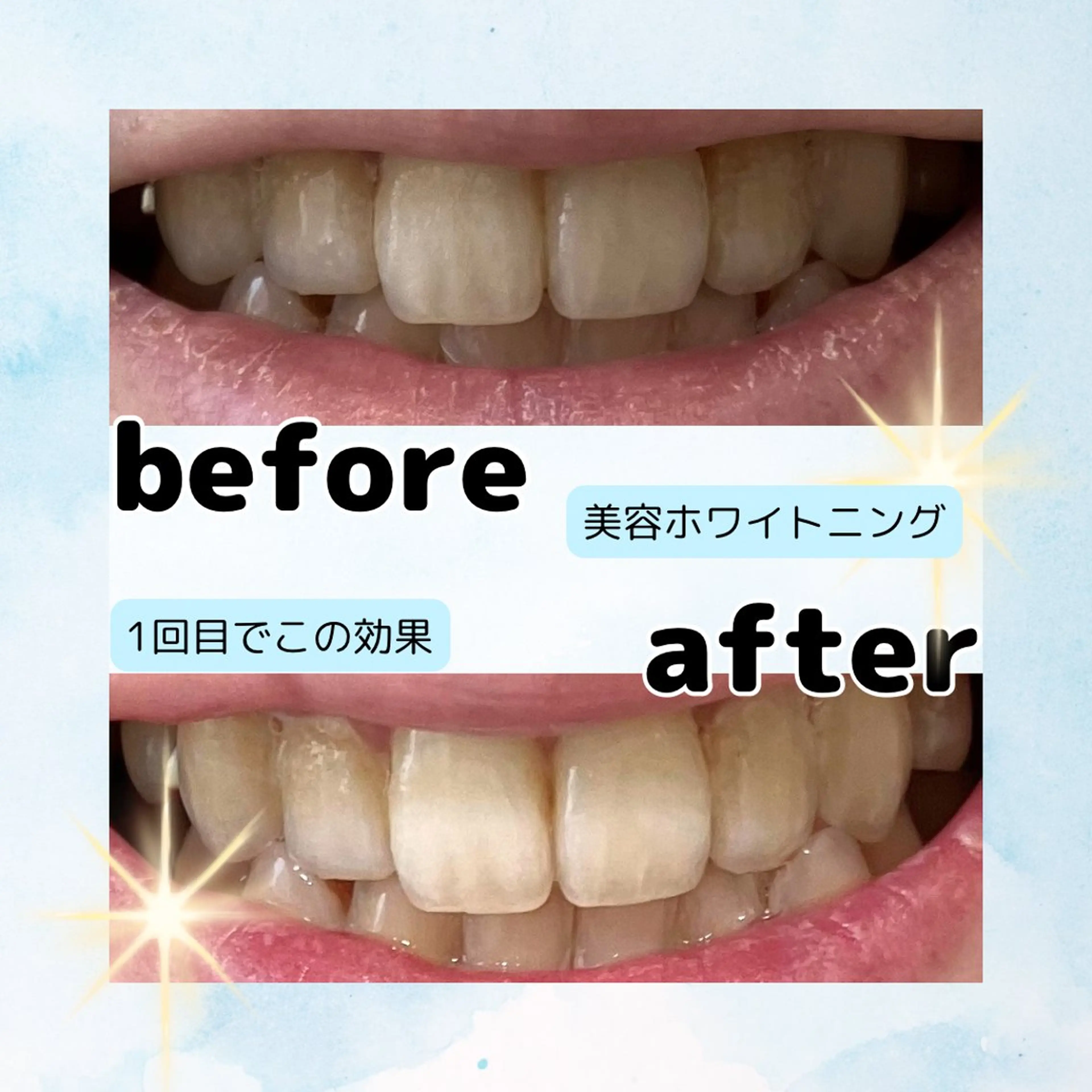 ホワイトニングサロン Soleilのその他イメージ