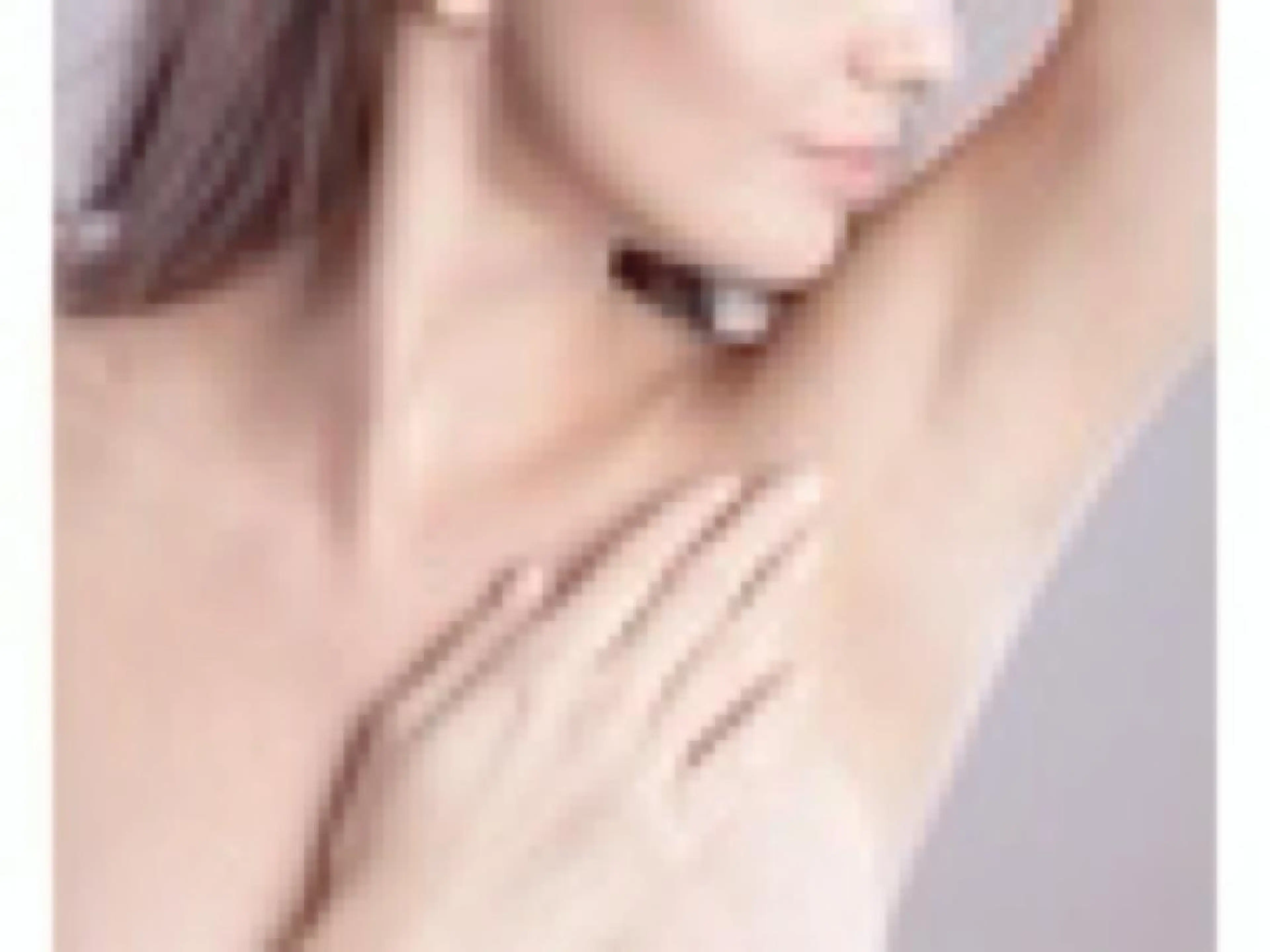 【ミニモ限定🎉】ポツポツ毛穴／黒ずみにも🙆‍♀️　　　　　​〜​両ワキ脱毛​〜​の写真