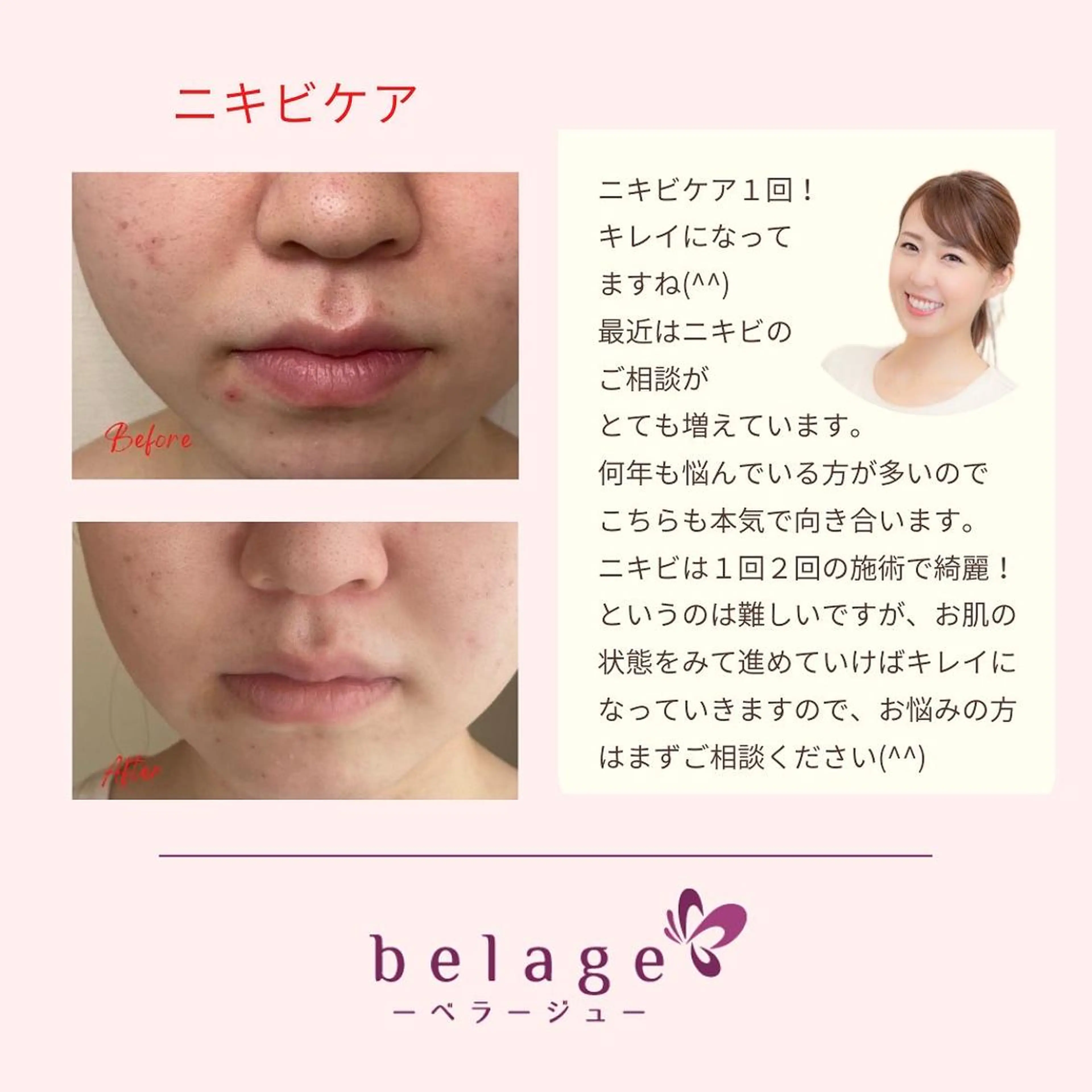 ベラージュ【美背中・ 美尻・フェイシャル】のエステ・リラクイメージ