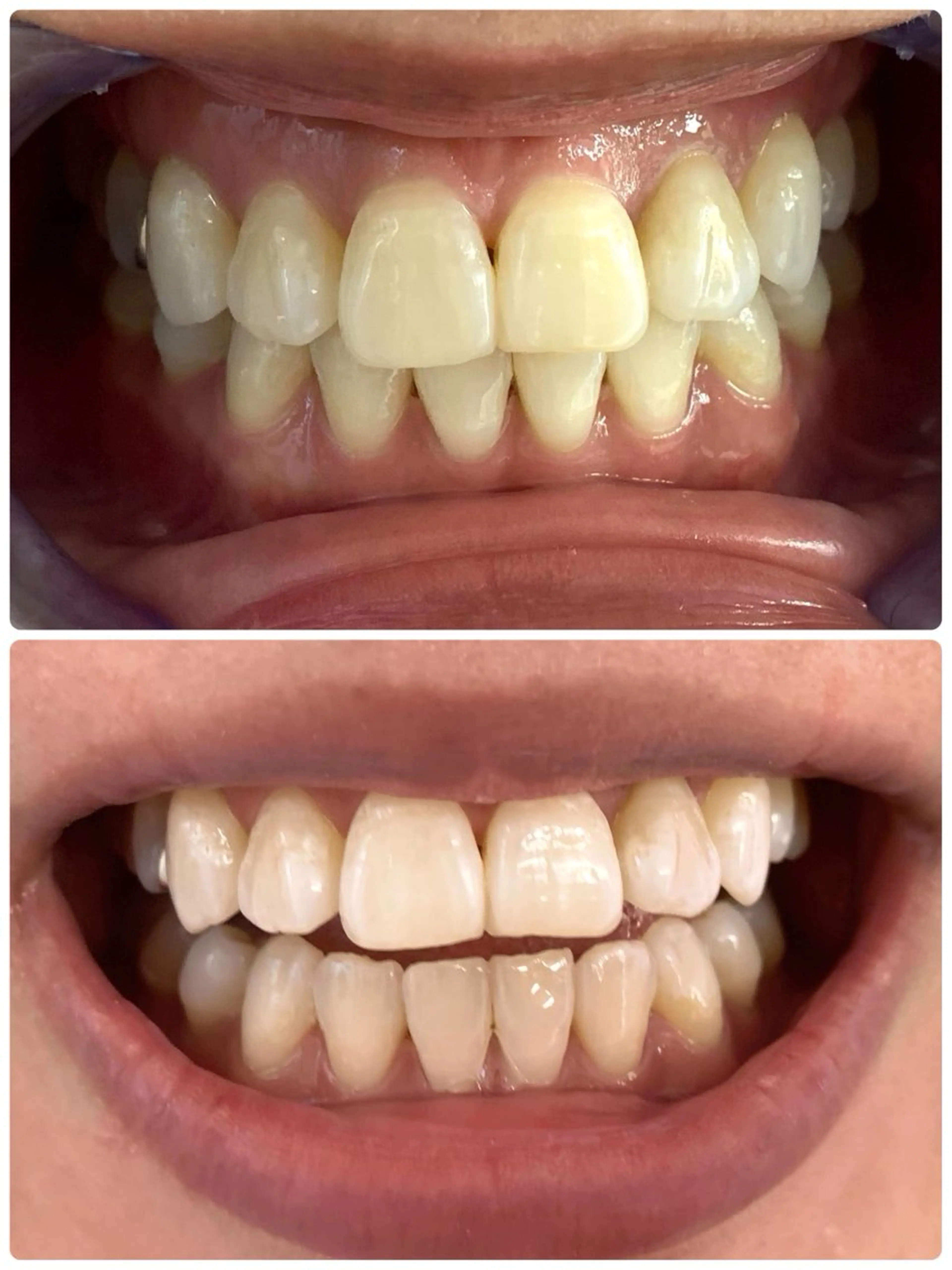 その他 エクシア ホワイト 宇治小倉店のその他イメージ