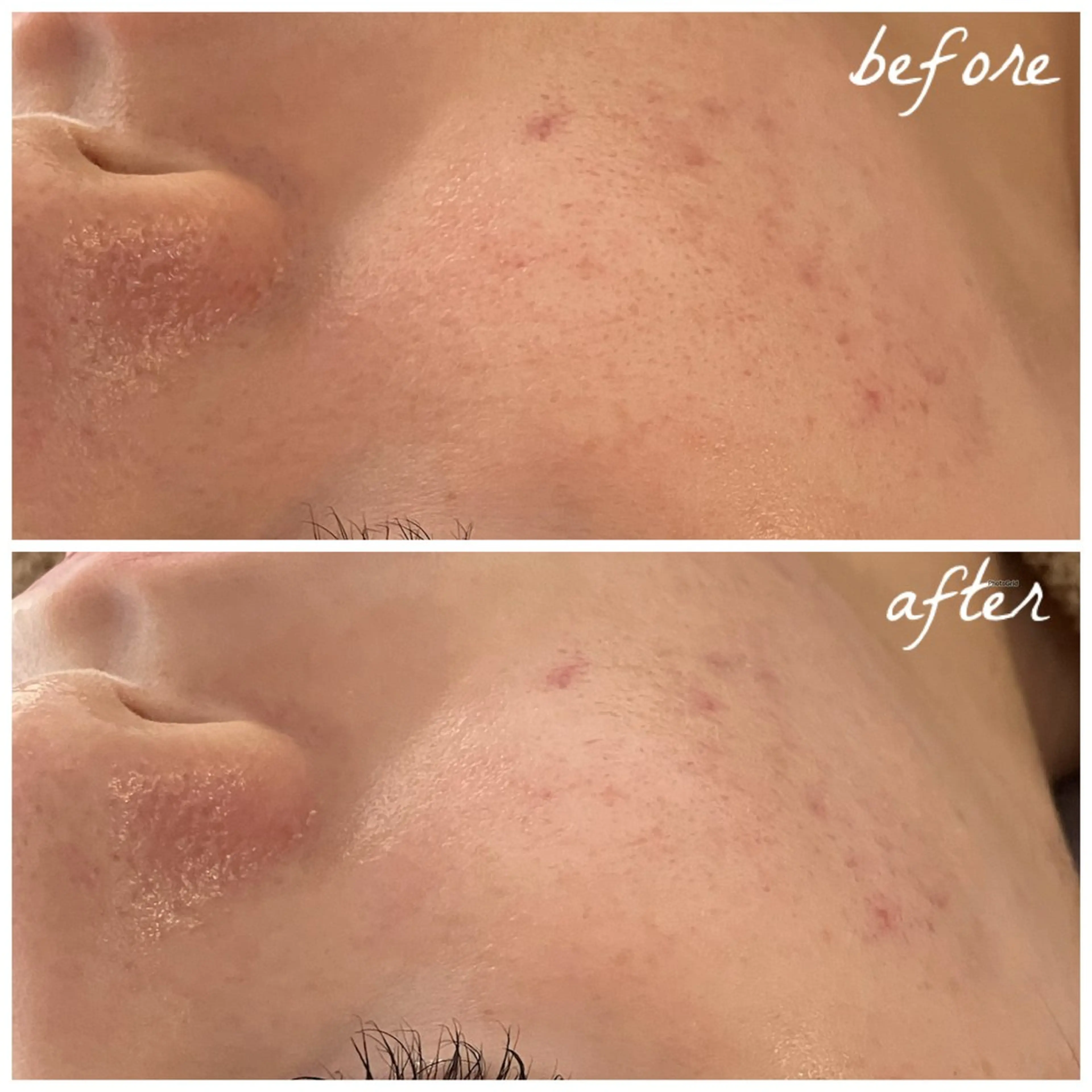 メンズ メナード岐阜茜部 杉浦のエステ・リラクイメージ