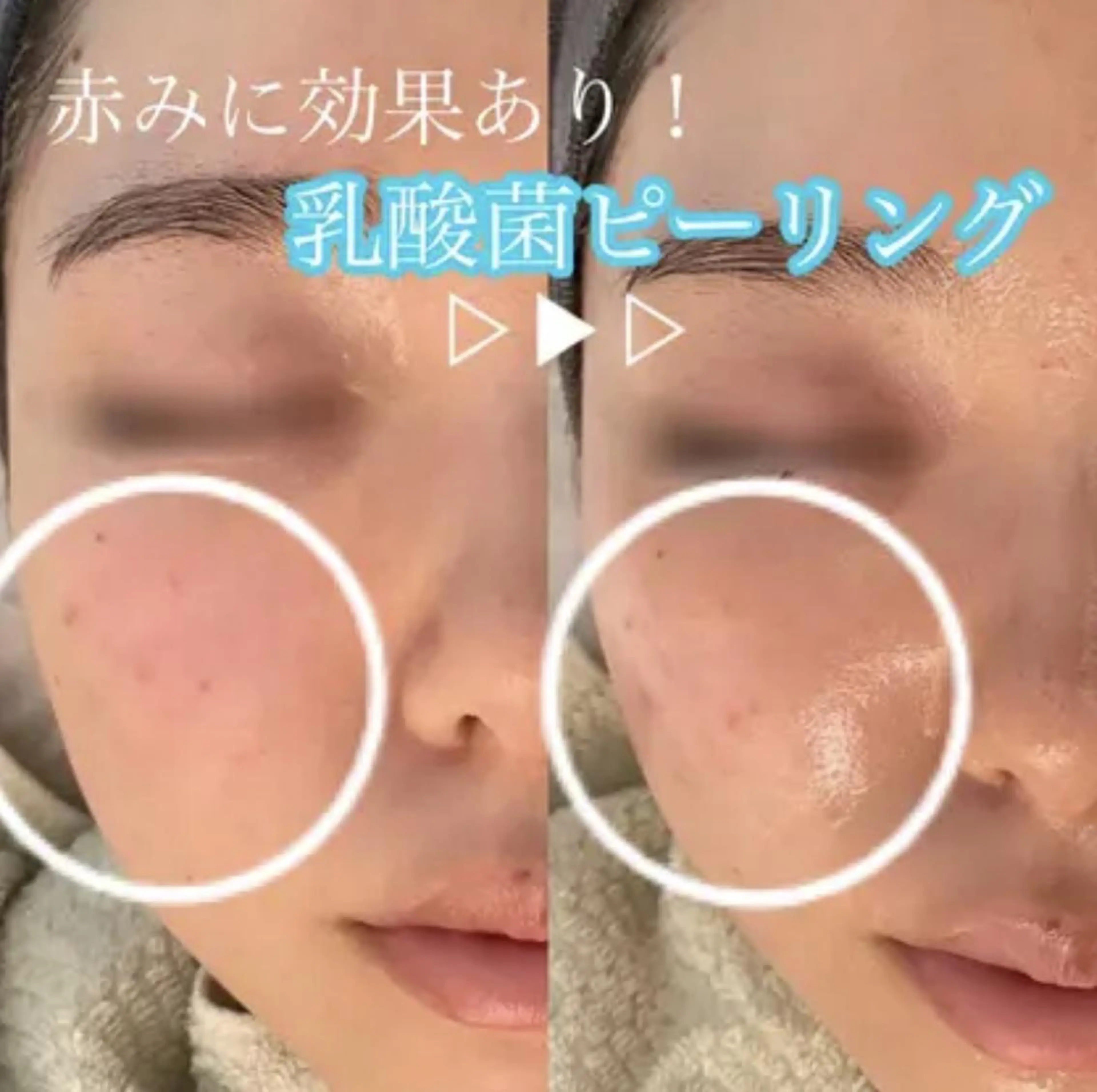 エステ 肌質改善 KALANCHOEのエステ・リラクイメージ