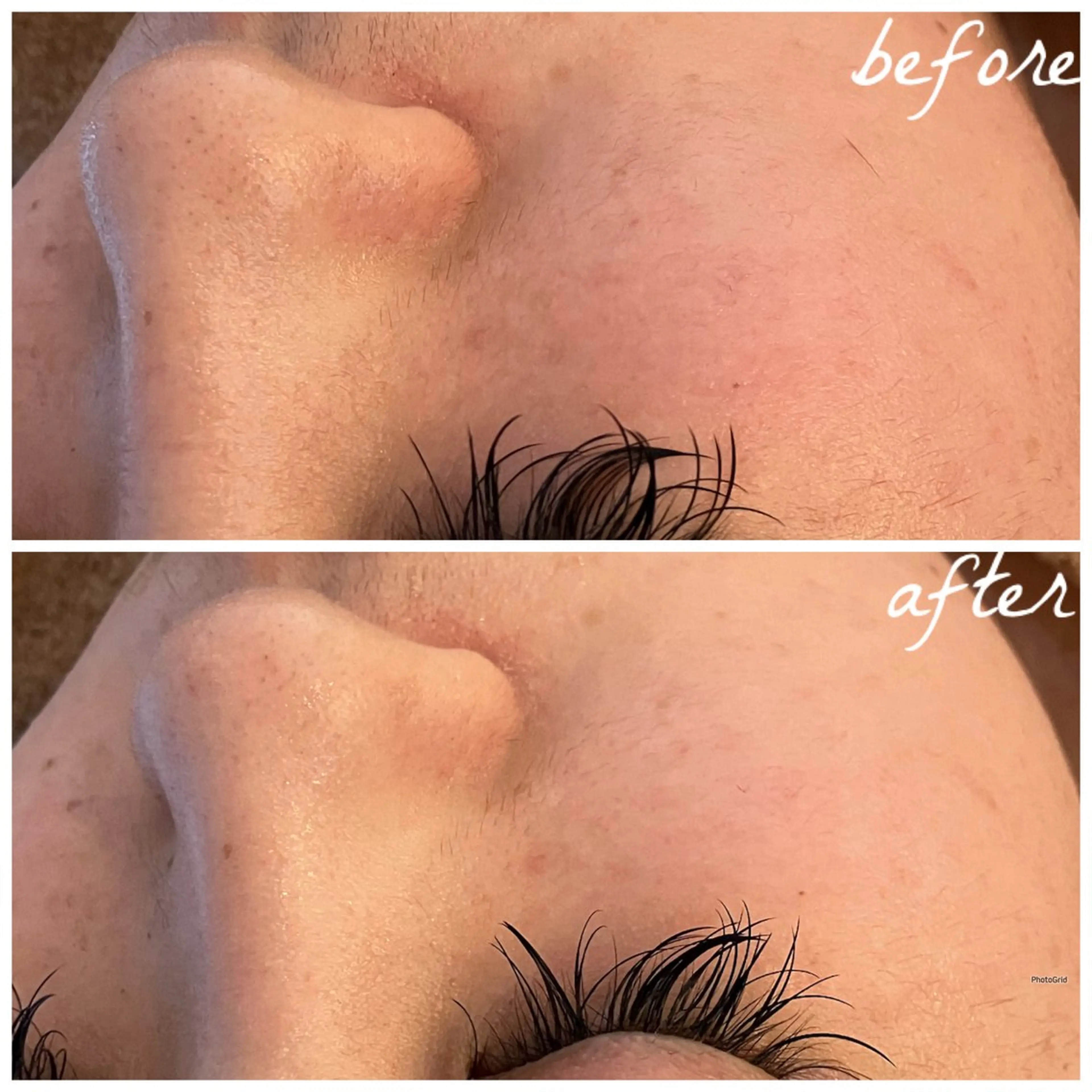 メンズ エステ メナード岐阜茜部 杉浦のエステ・リラクイメージ