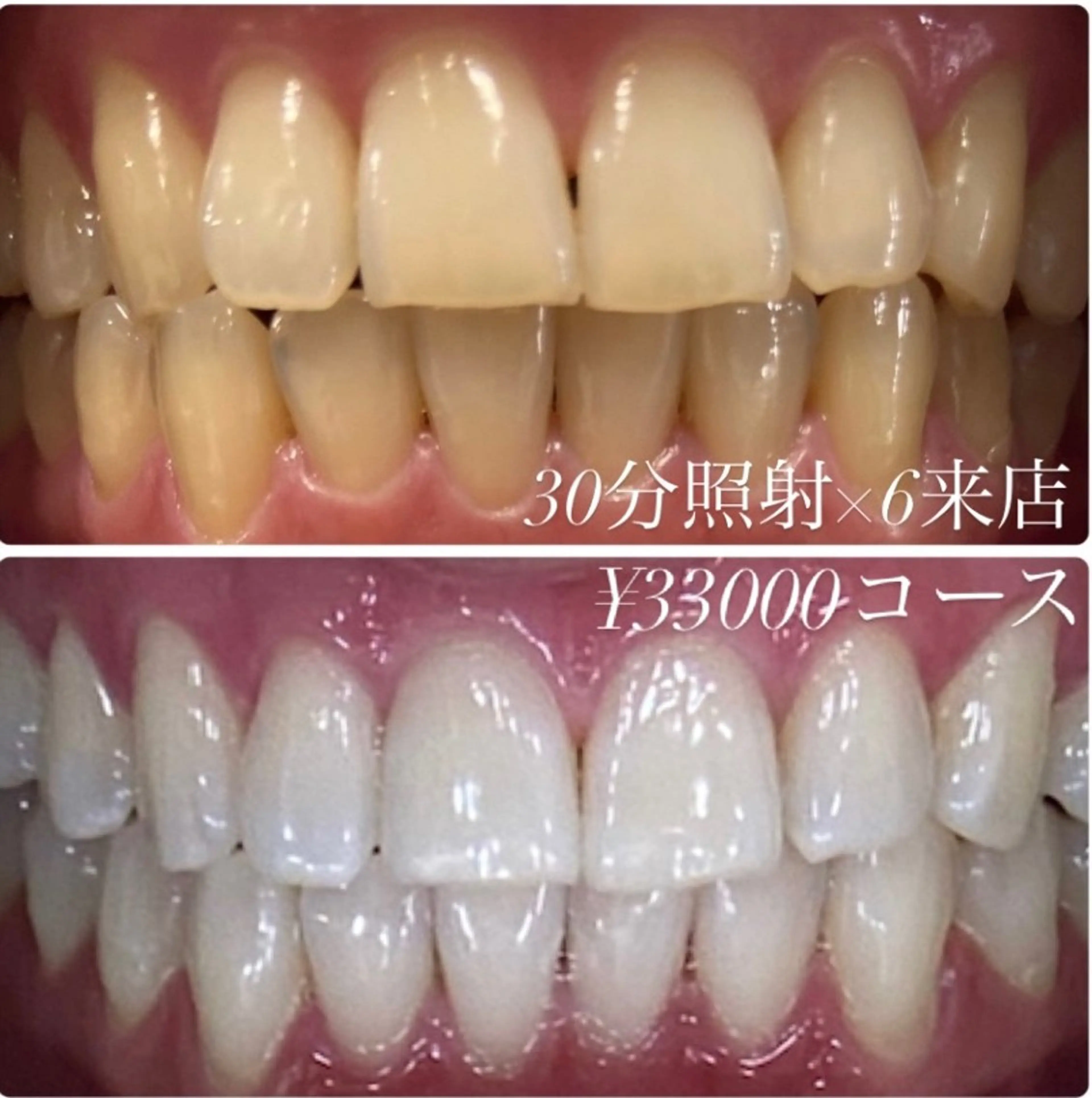 その他 ホワイトニングルーム　川崎店所属・ホワイトニング ルーム　川崎店のその他イメージ