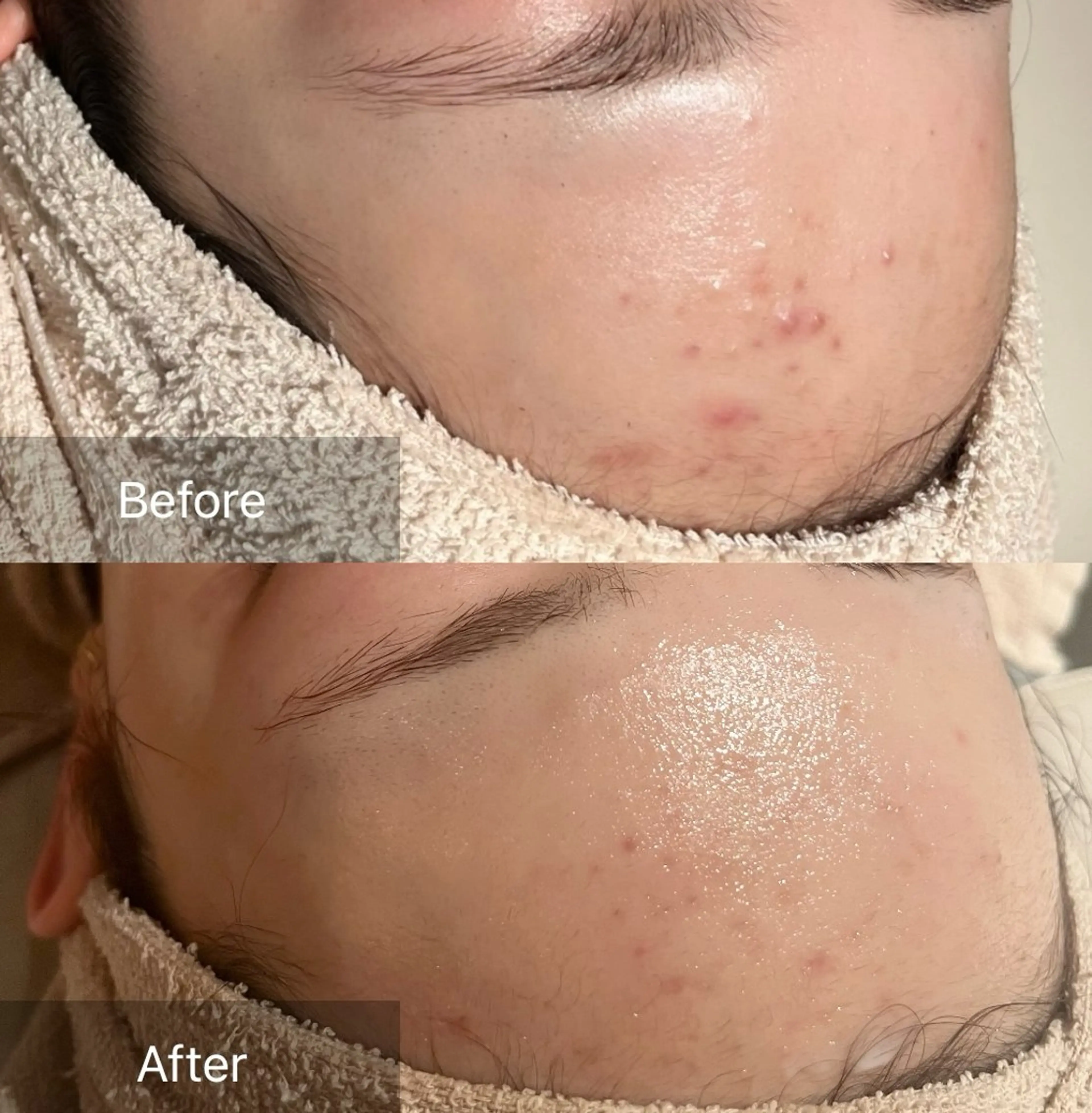 その他 for woman所属・森 美優のエステ・リラクイメージ