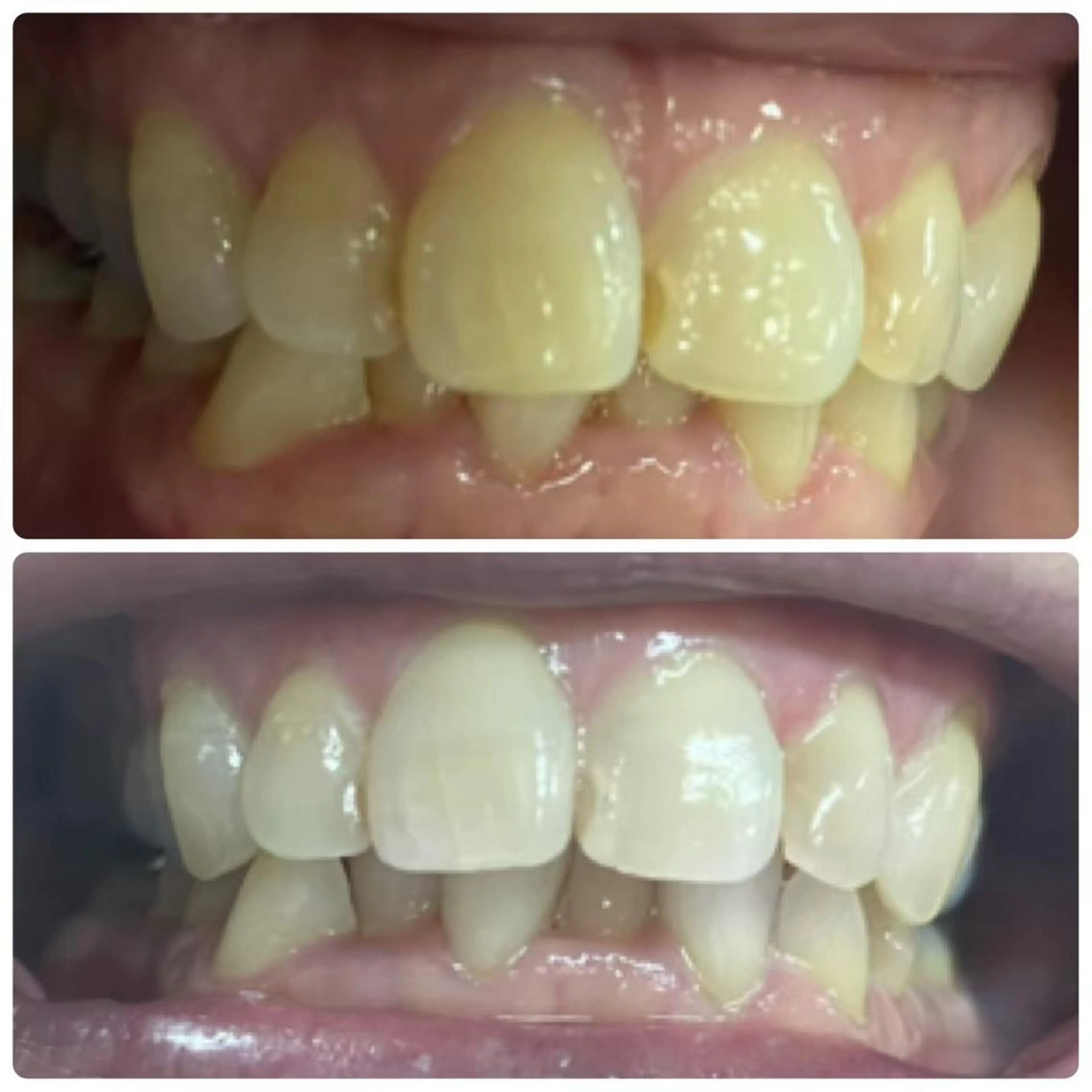 メンズ LOVEホワイト ニング恵比寿店のその他イメージ